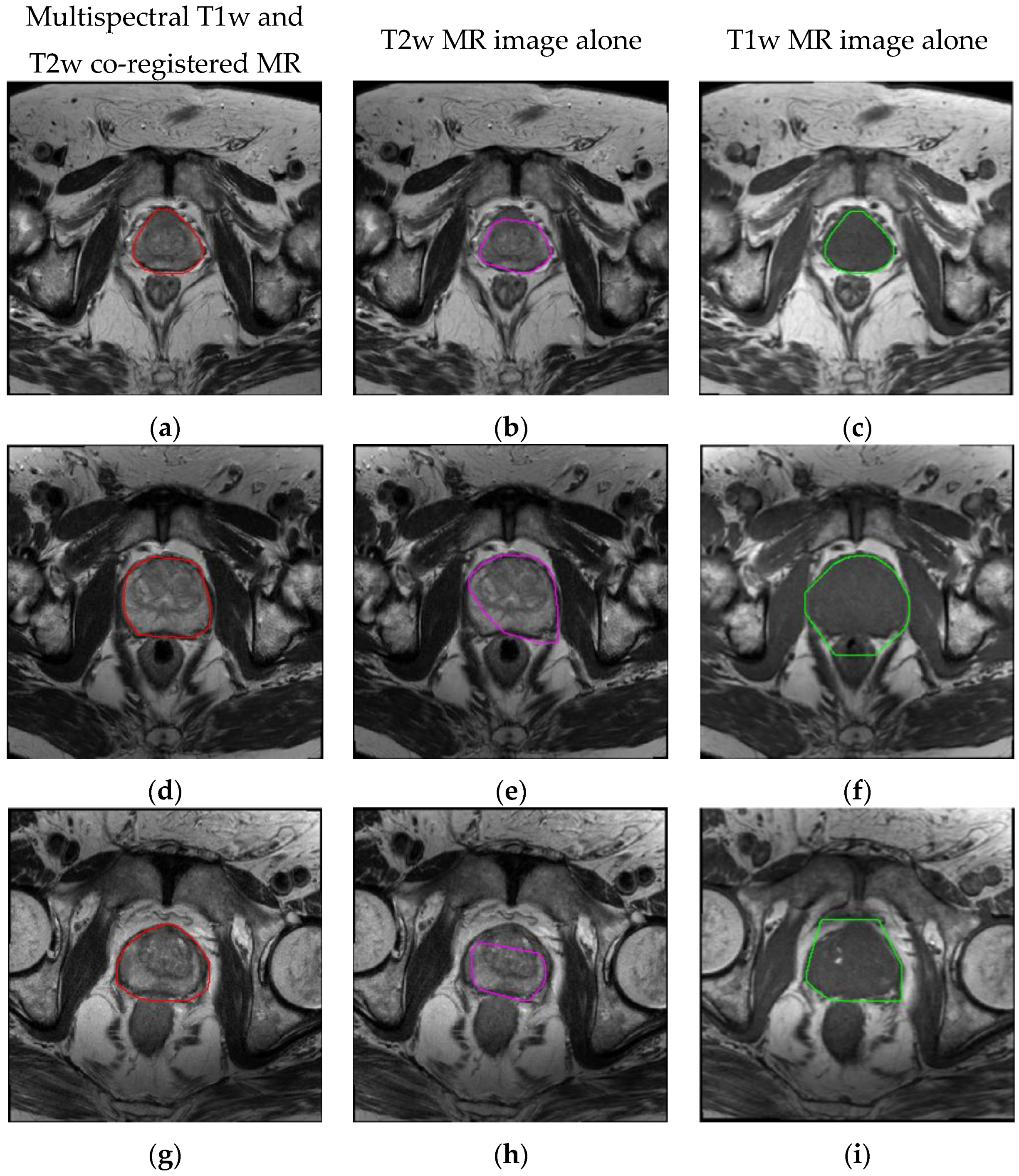 Information 08 00049 g005