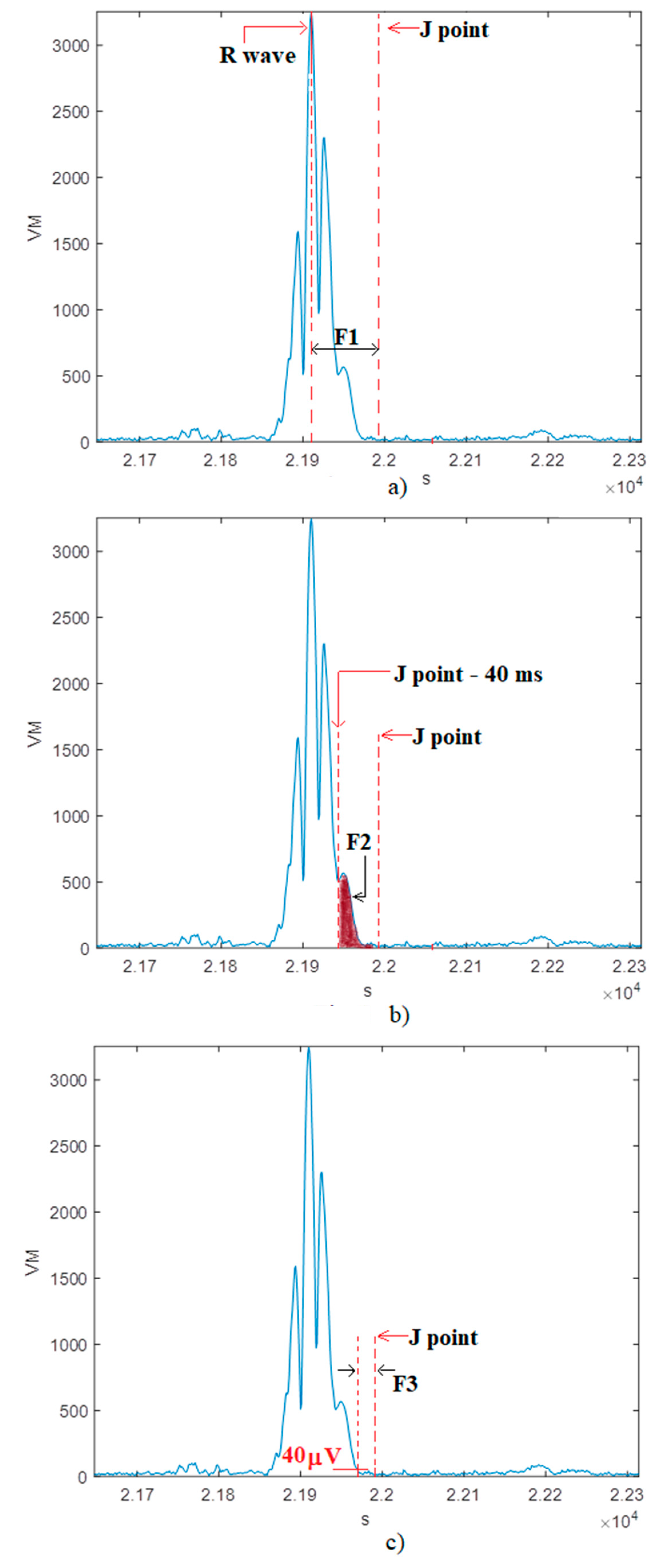 Information 10 00328 g005