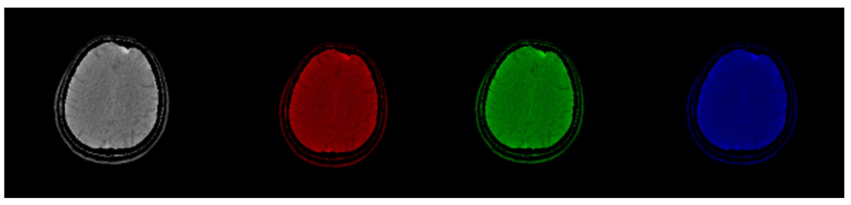 Information 16 00352 g002