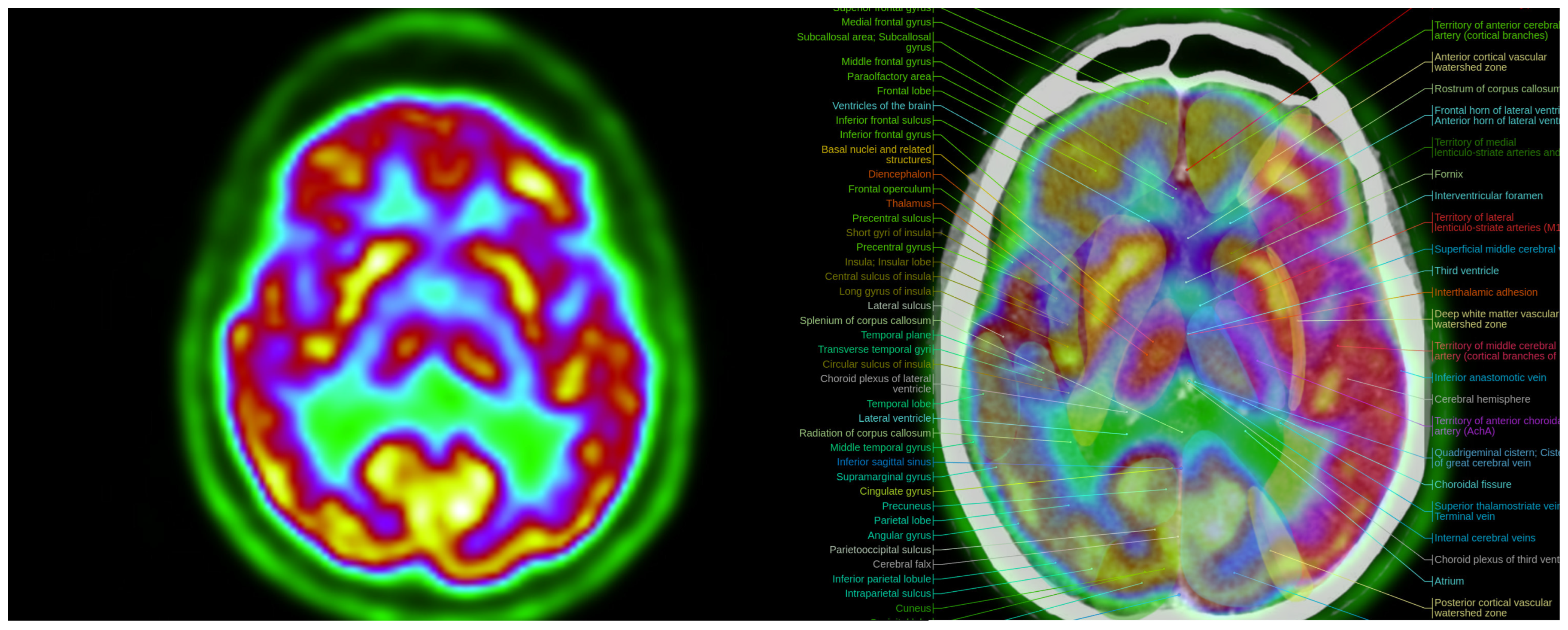 Information 16 00352 g011