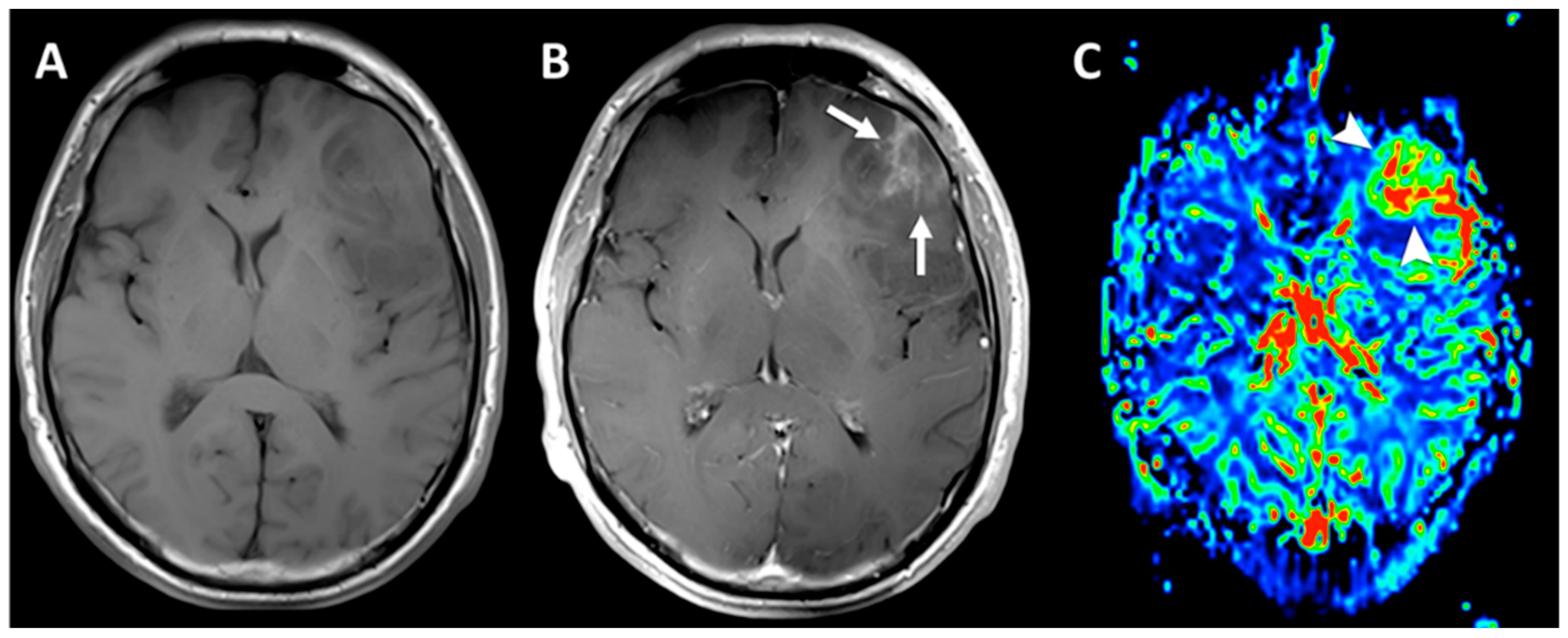Inorganics 07 00018 g002