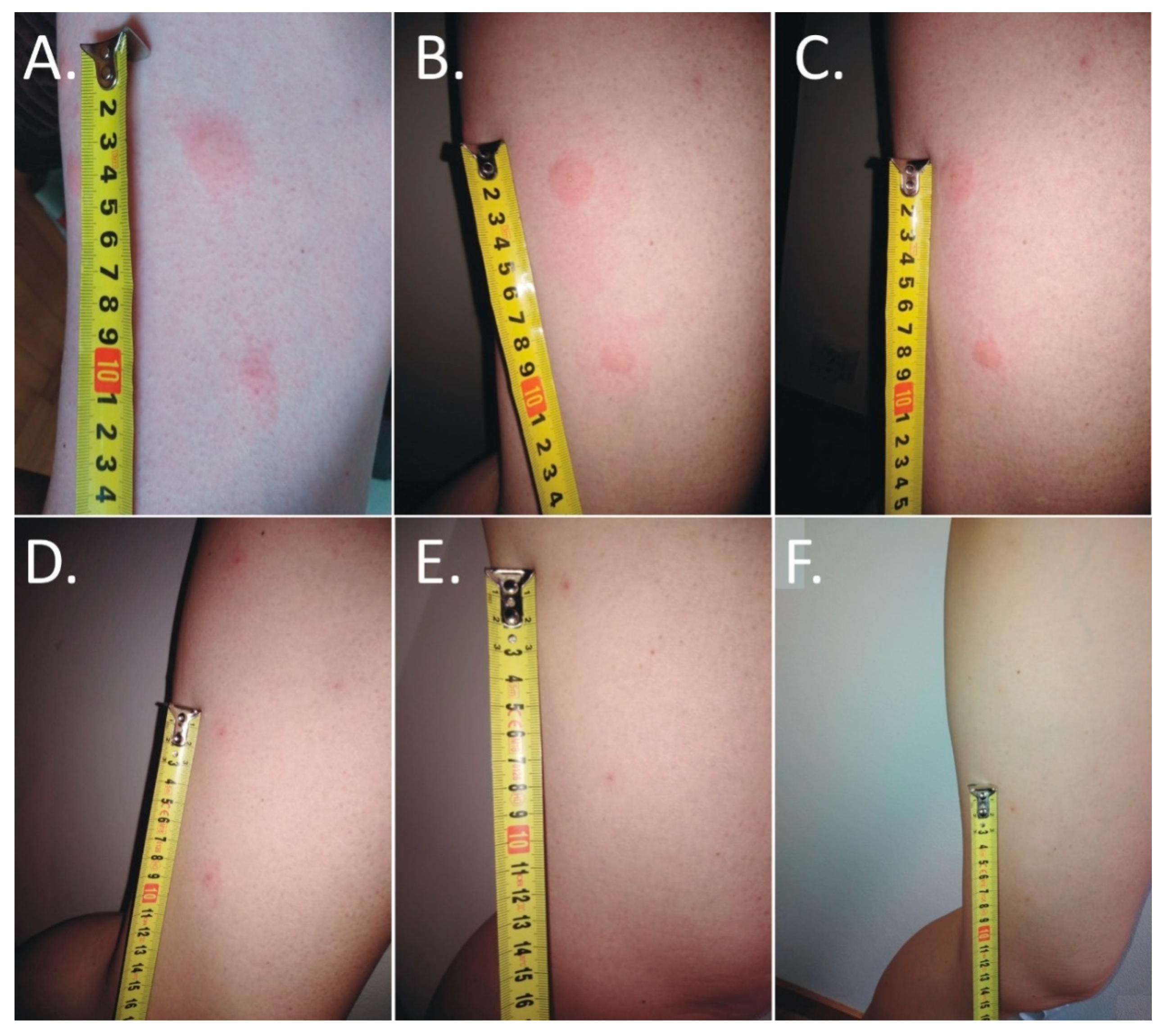 Insects 11 00859 g001