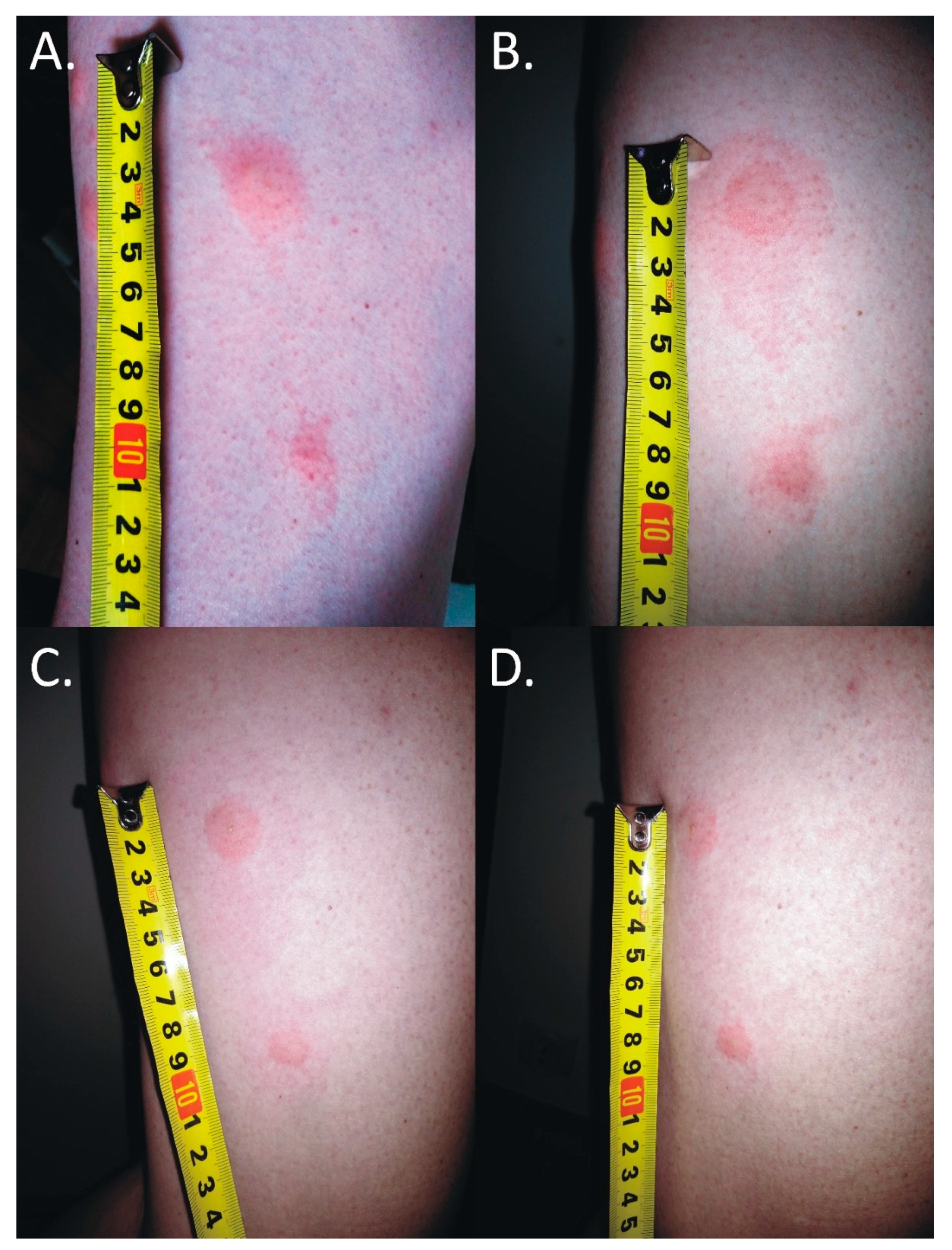 Insects 11 00859 g002