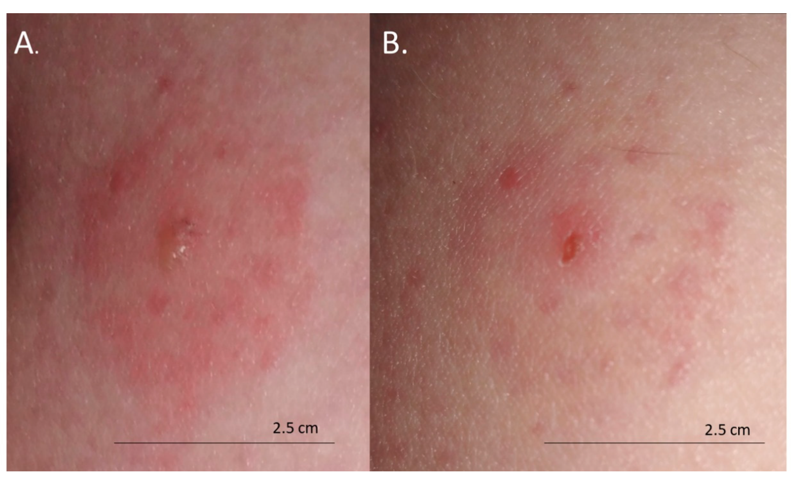 Insects 11 00859 g003