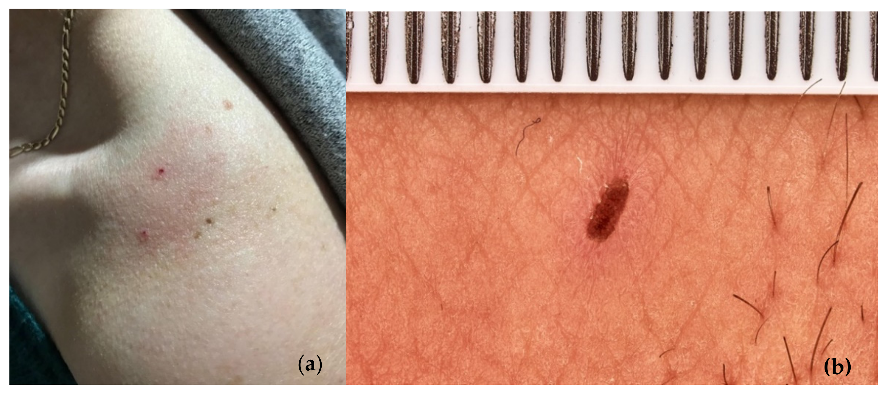 Insects 13 00158 g021