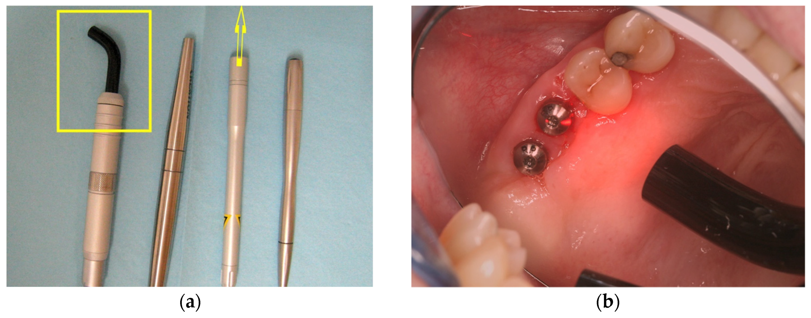 Inventions 08 00046 g001 Inventions 08 00046 g001