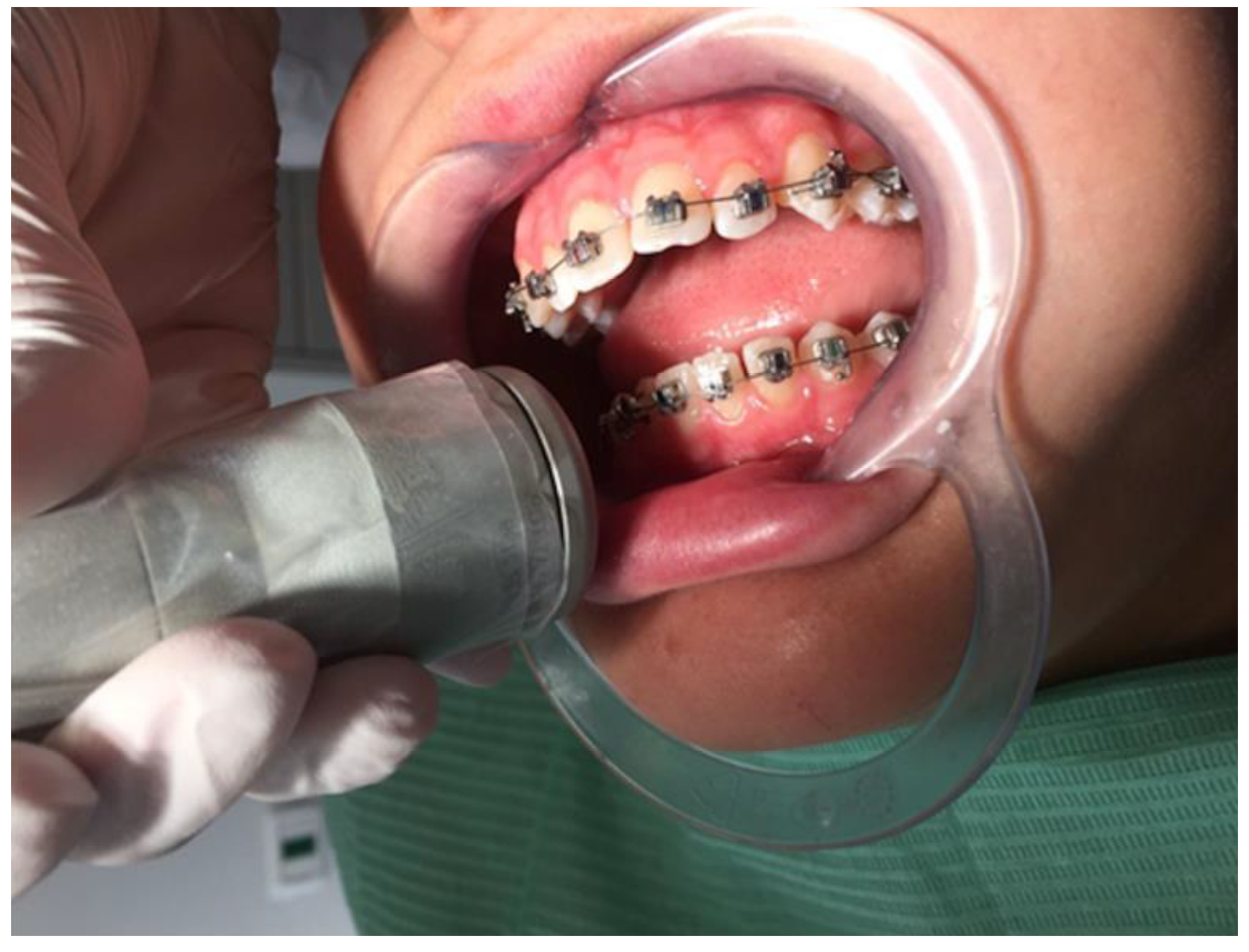 Inventions 08 00046 g002 Inventions 08 00046 g002