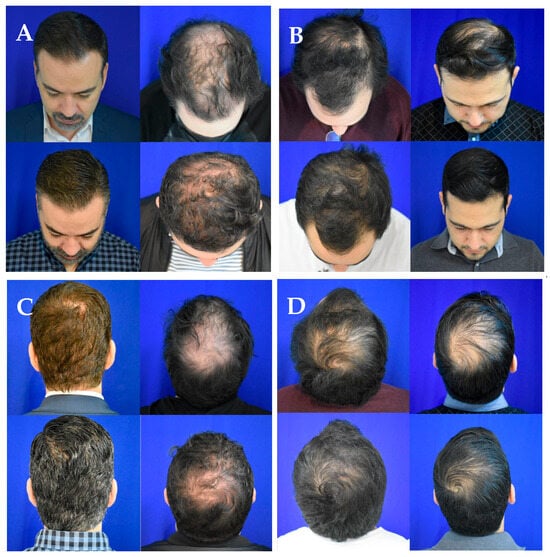 Jaestheticmed 01 00006 g0a1