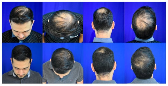 Jaestheticmed 01 00006 g0a2