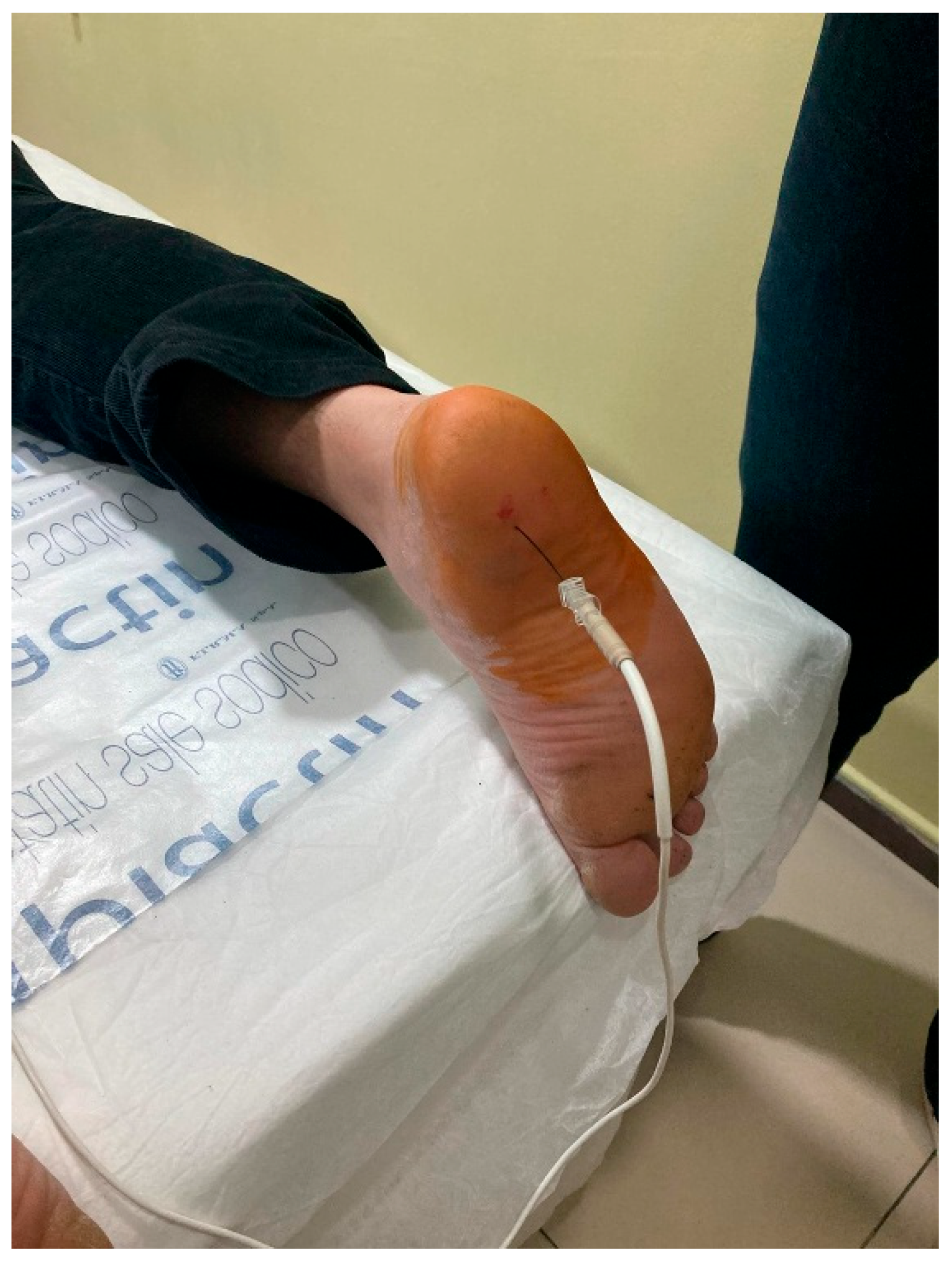 Japma 116 00003 g002 Japma 116 00003 g002