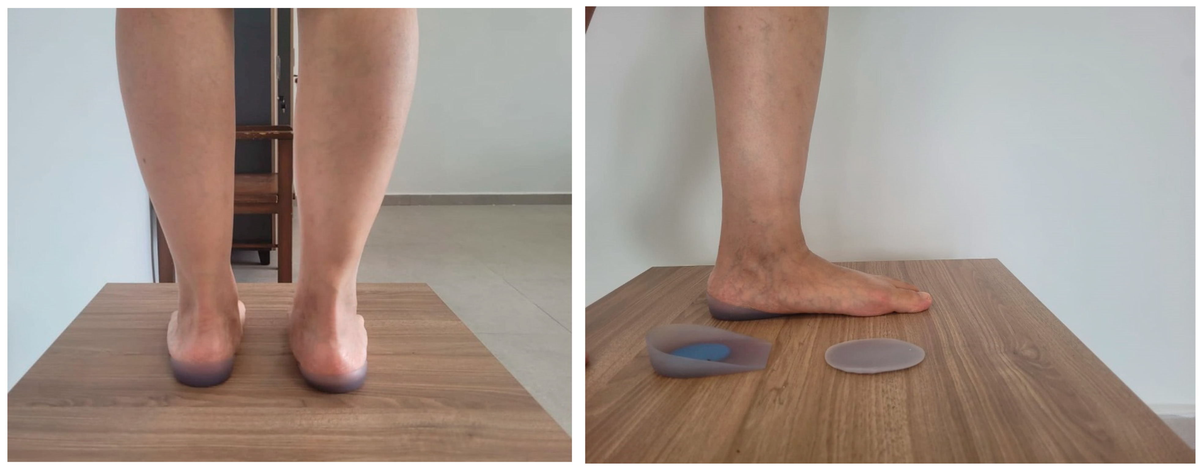 Japma 116 00003 g004 Japma 116 00003 g004