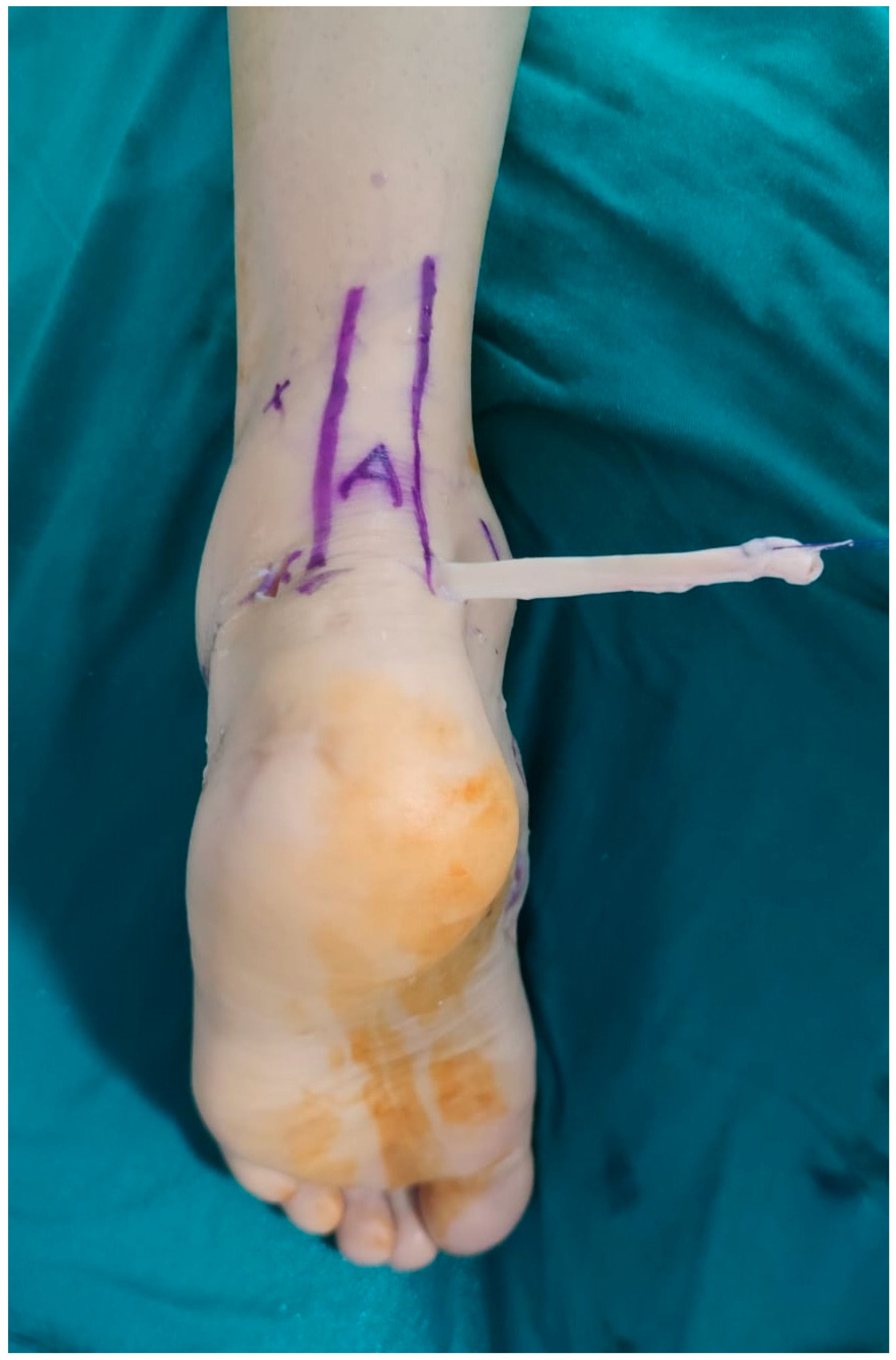 Japma 116 00007 g005 Japma 116 00007 g005