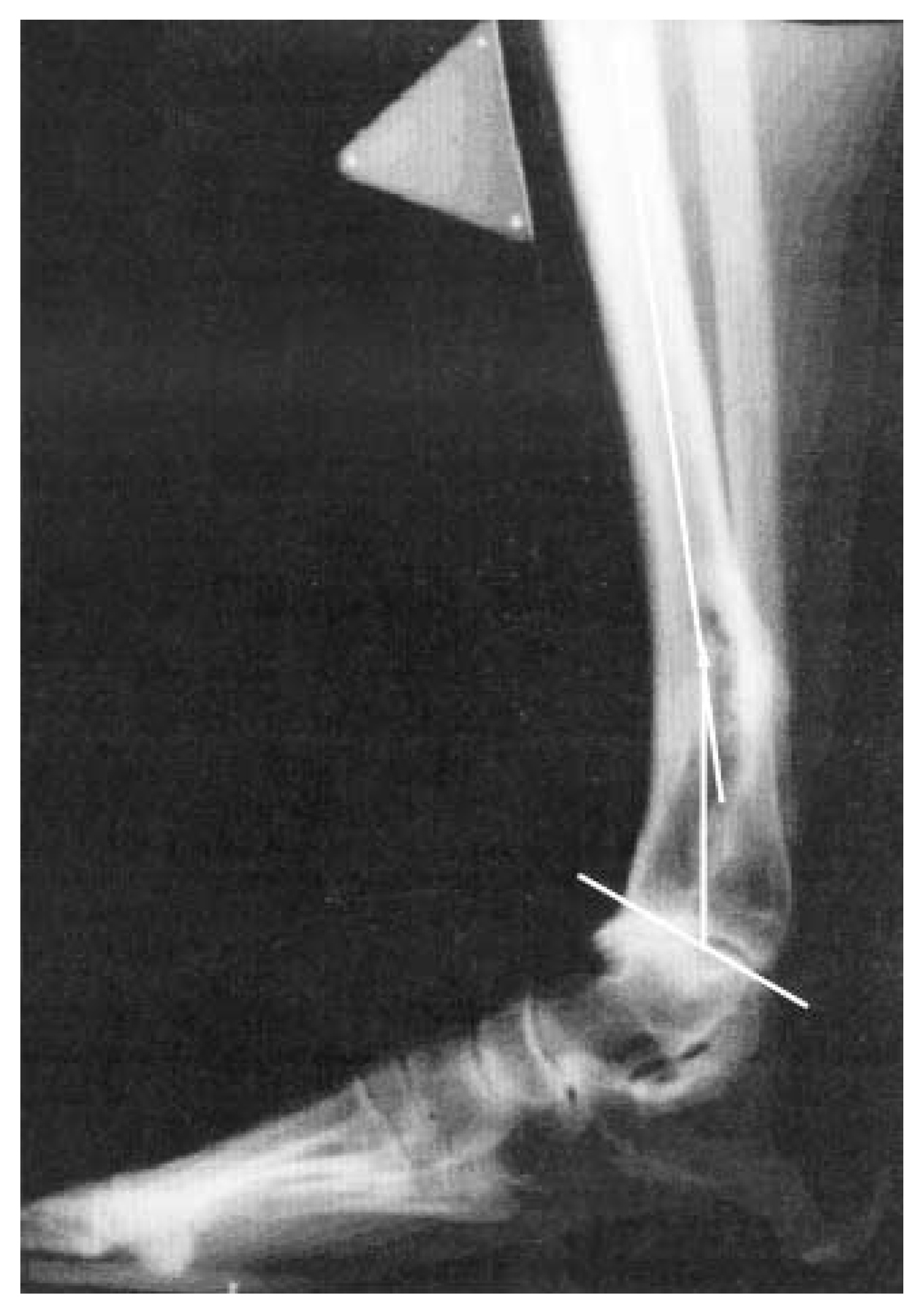 Japma 95 00002 g011