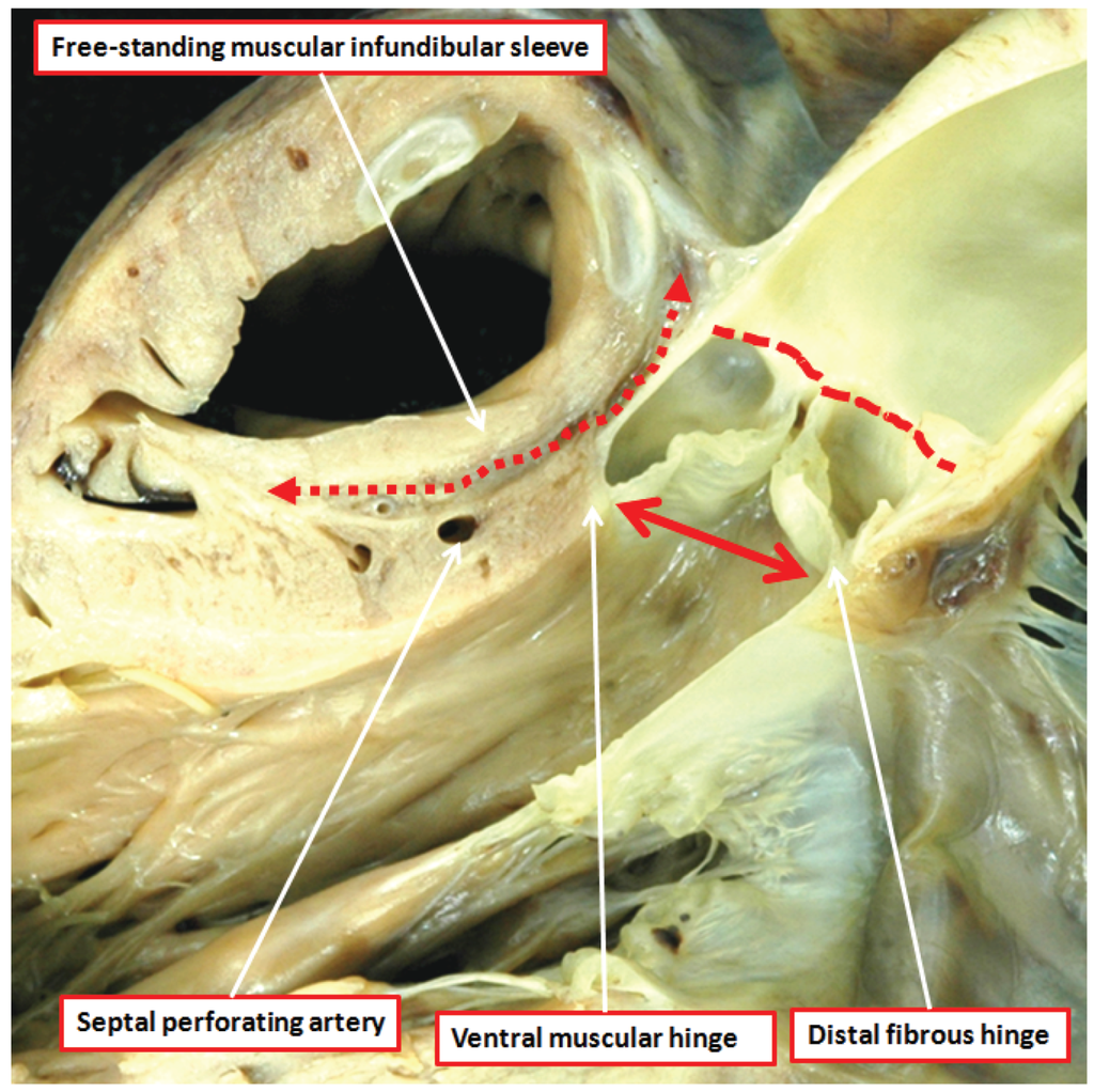 Jcdd 01 00177 g005 1024