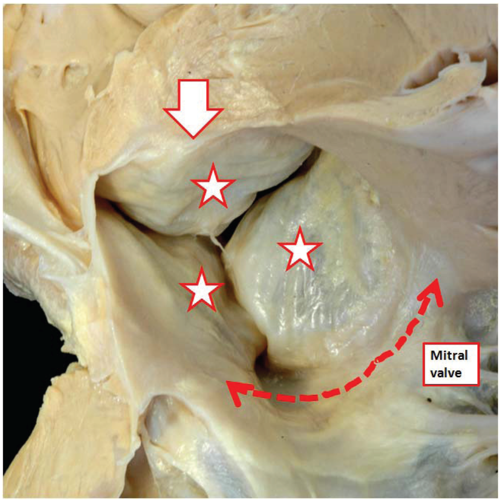 Jcdd 01 00177 g006 1024