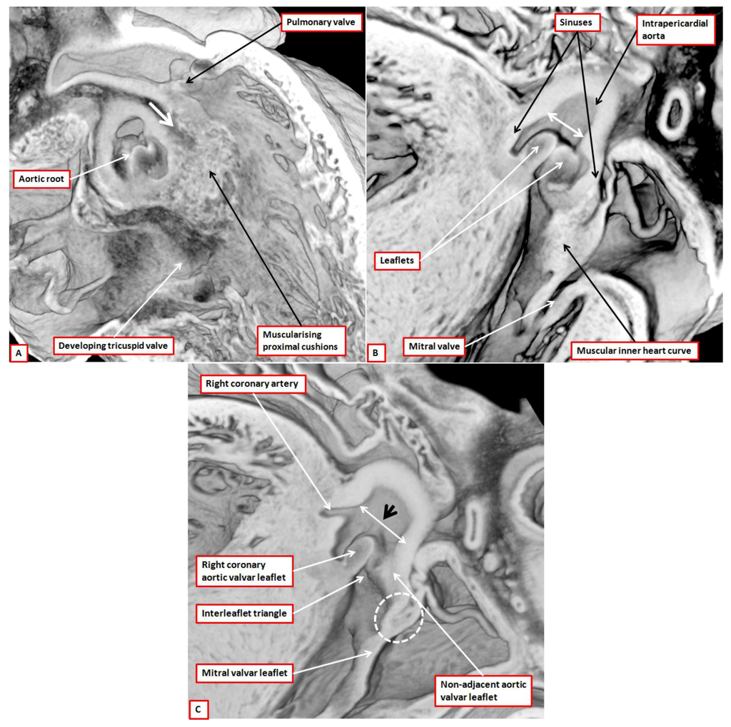 Jcdd 01 00177 g012 1024