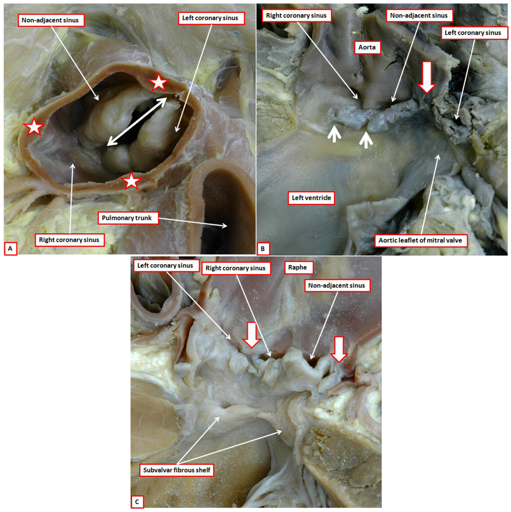 Jcdd 01 00177 g014 1024