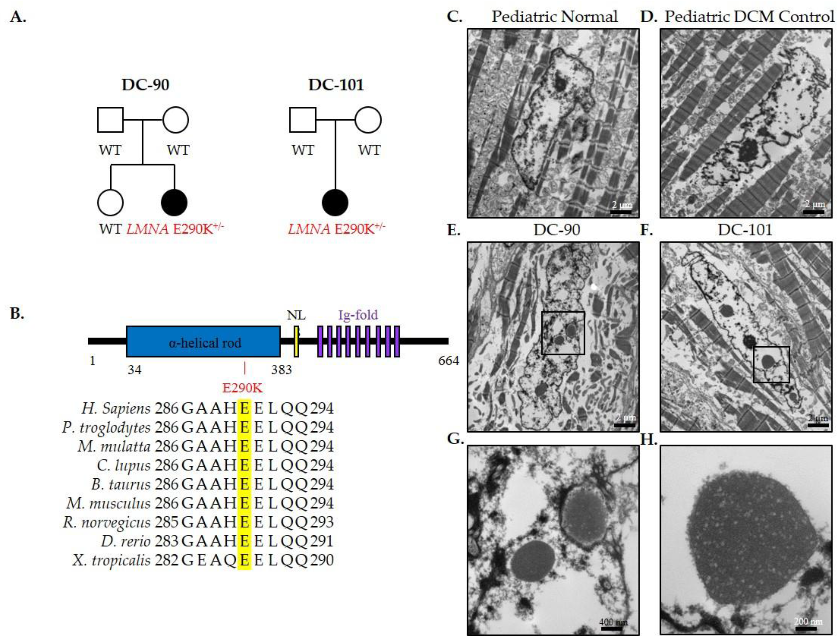 Jcdd 04 00011 g004 Jcdd 04 00011 g004