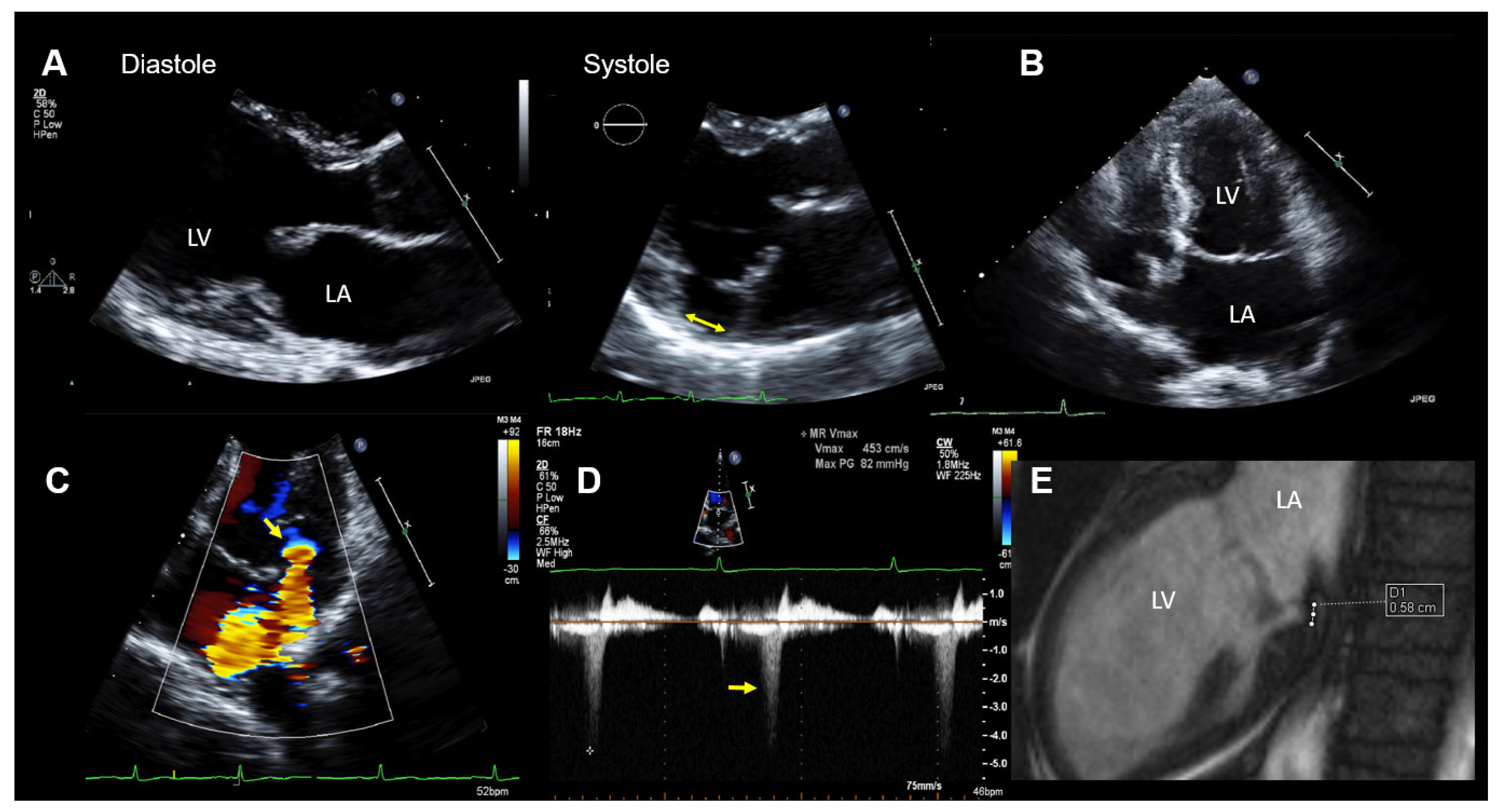 Jcdd 08 00009 g002 Jcdd 08 00009 g002