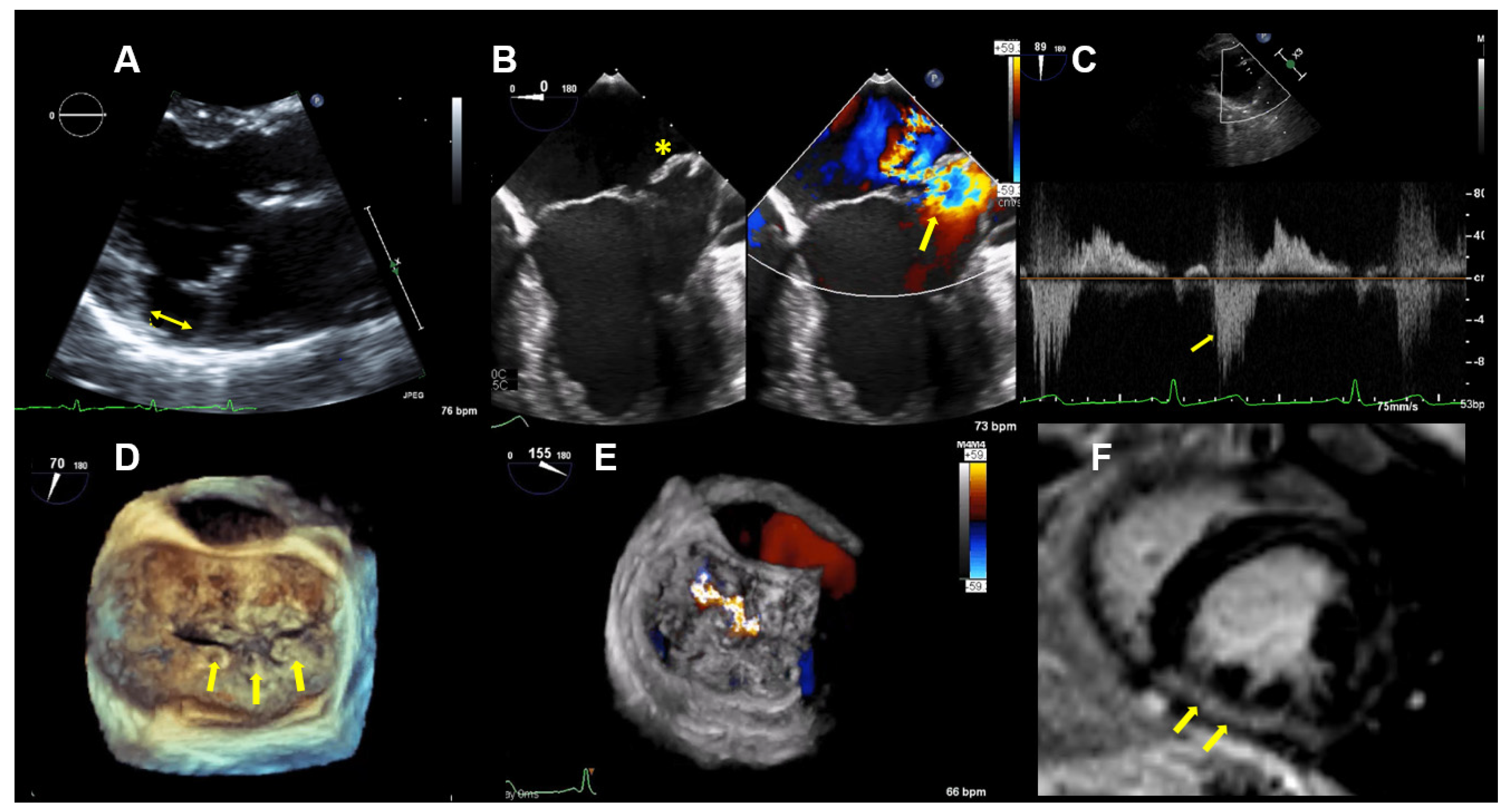 Jcdd 08 00009 g003 Jcdd 08 00009 g003