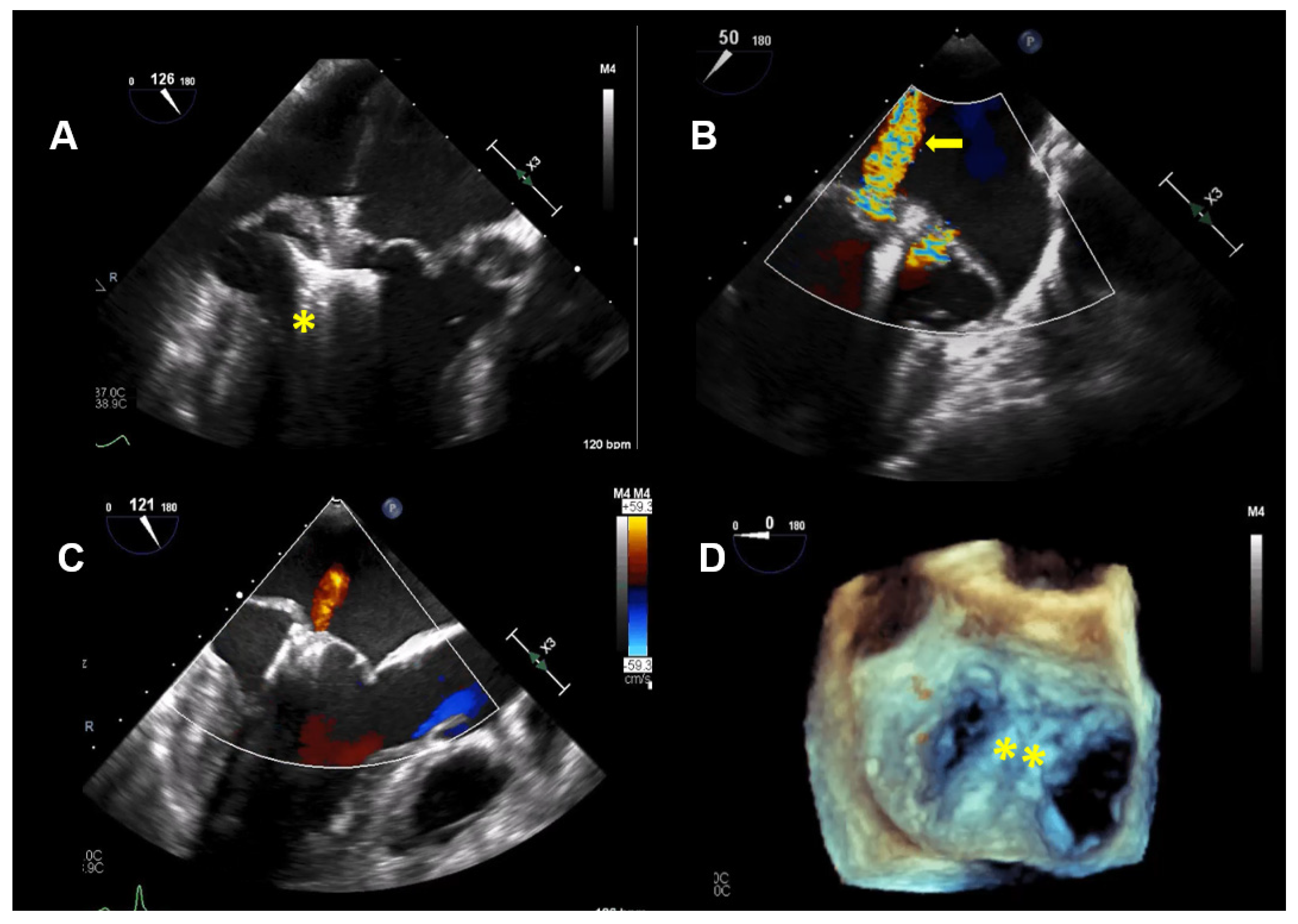 Jcdd 08 00009 g004 Jcdd 08 00009 g004