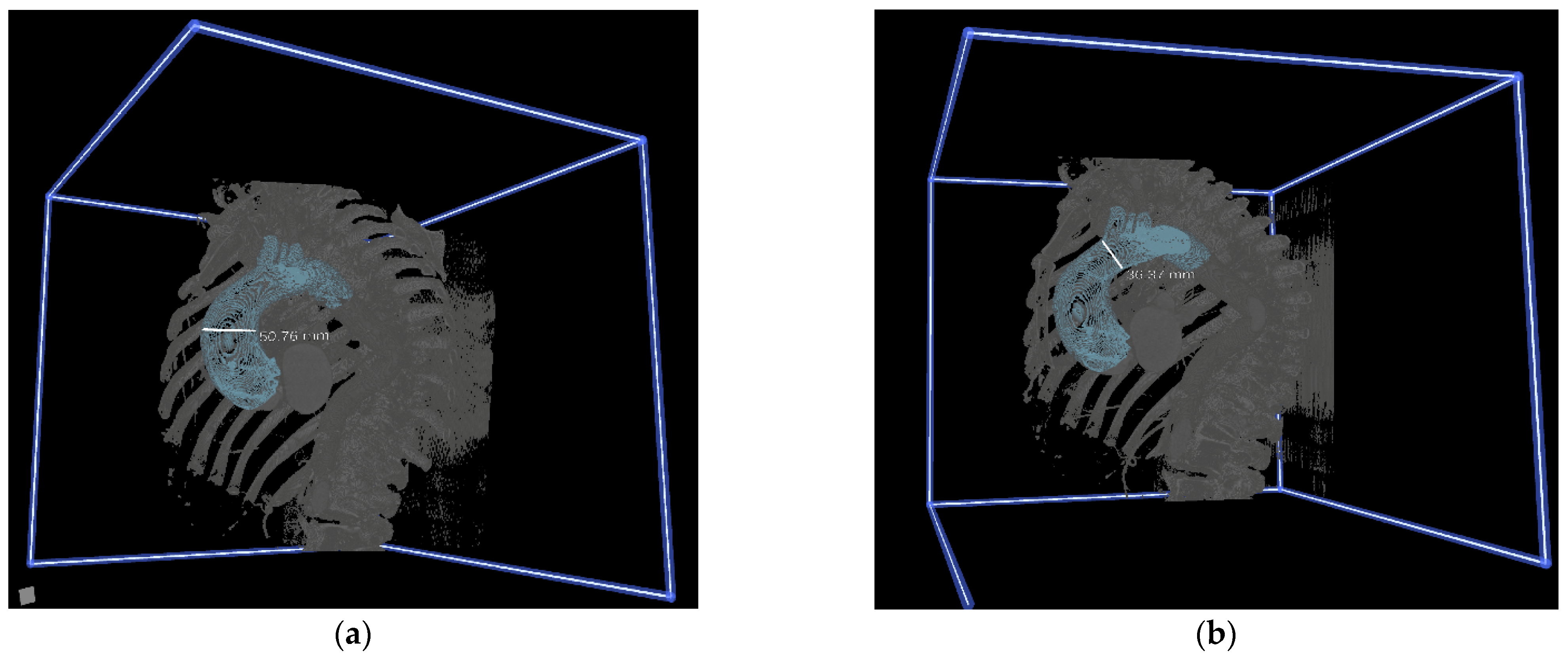 Jcdd 09 00031 g001a Jcdd 09 00031 g001a