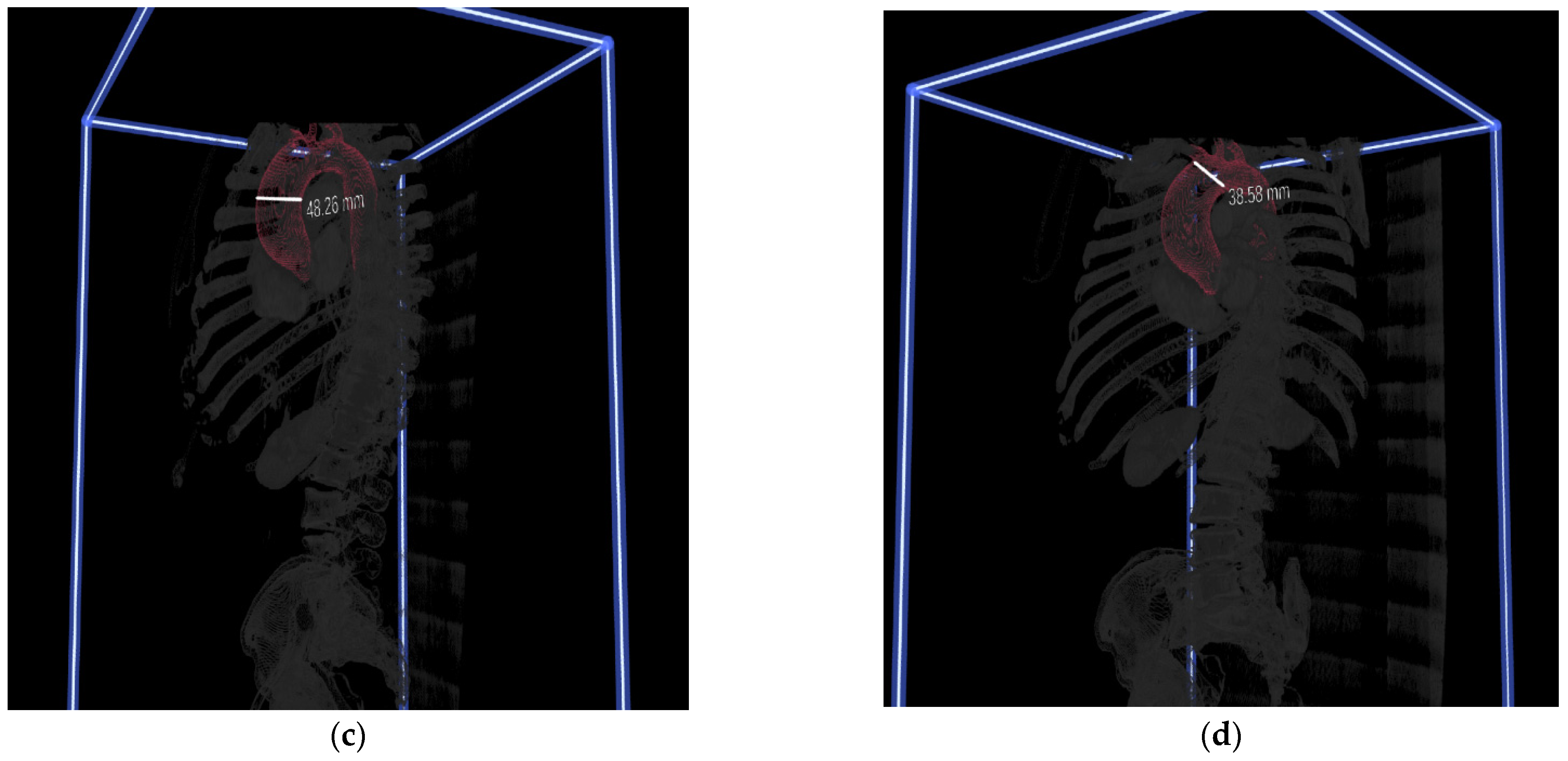 Jcdd 09 00031 g001b Jcdd 09 00031 g001b