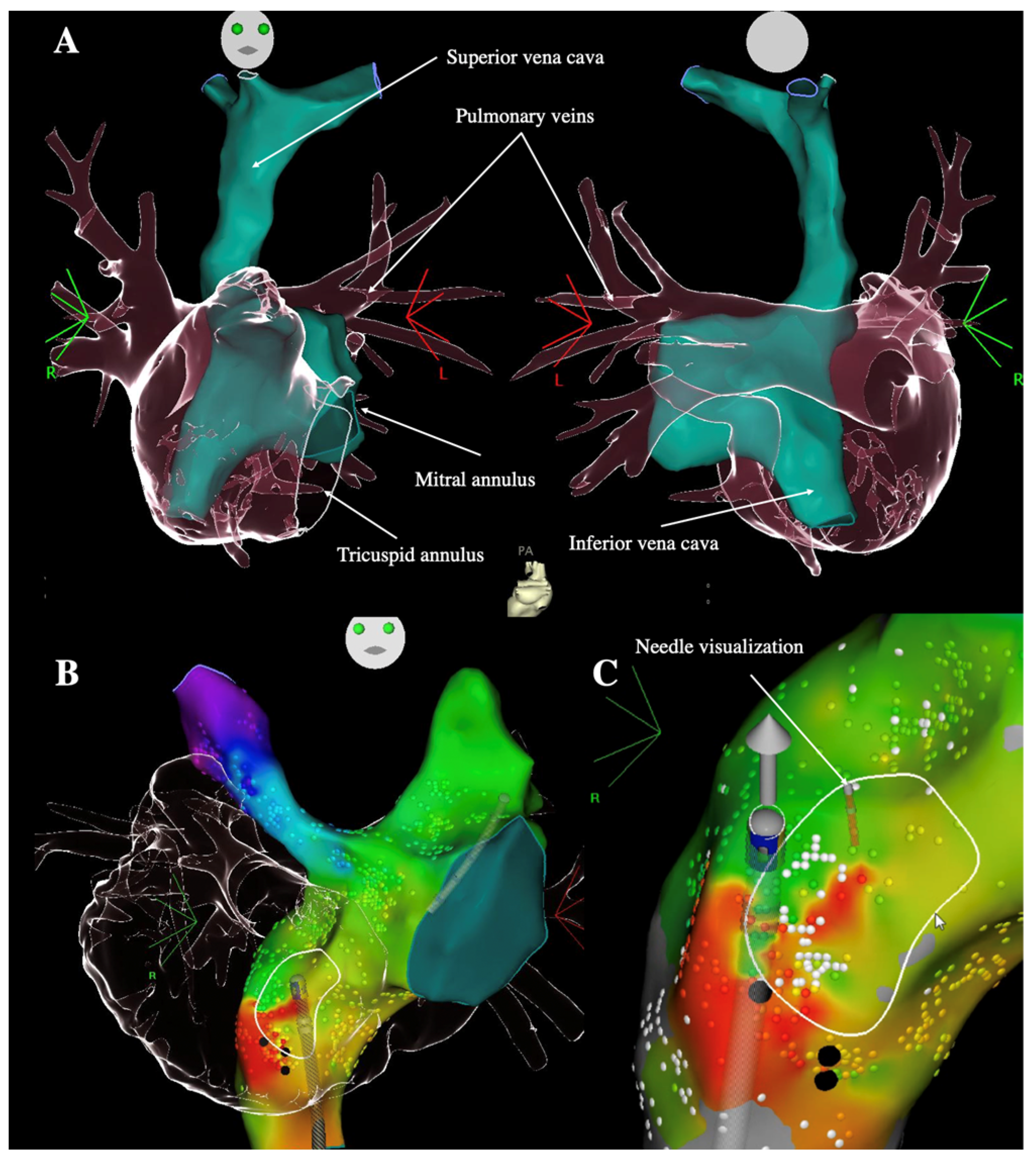 Jcdd 09 00039 g003 Jcdd 09 00039 g003