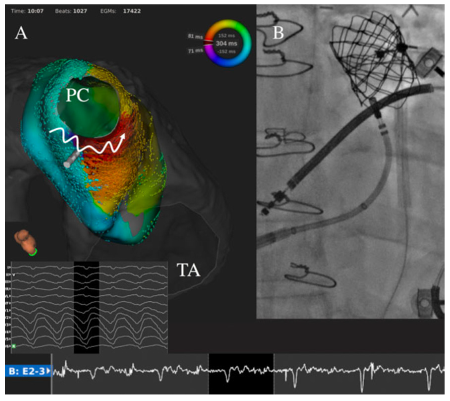 Jcdd 09 00039 g004 Jcdd 09 00039 g004