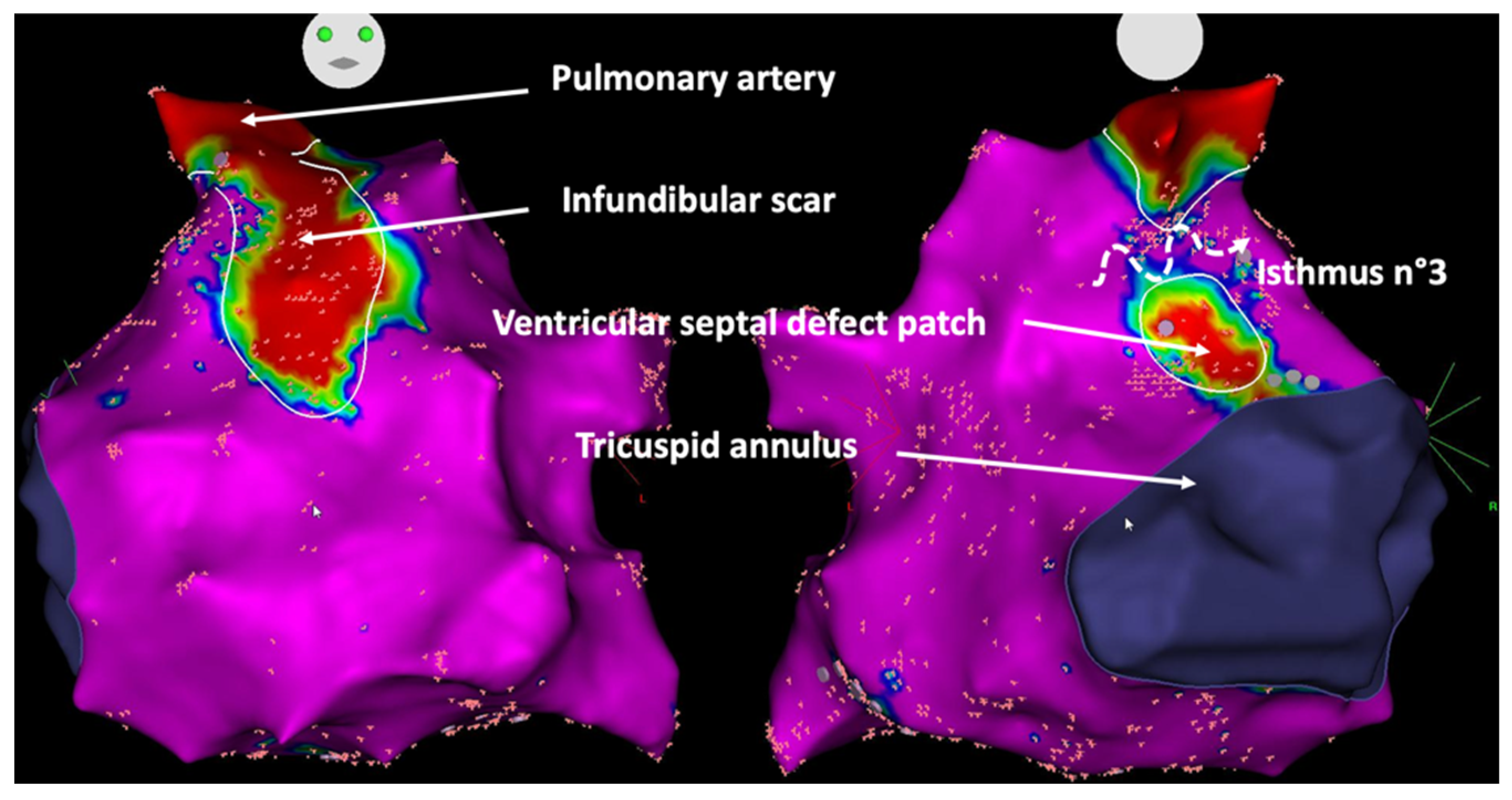 Jcdd 09 00039 g005 Jcdd 09 00039 g005
