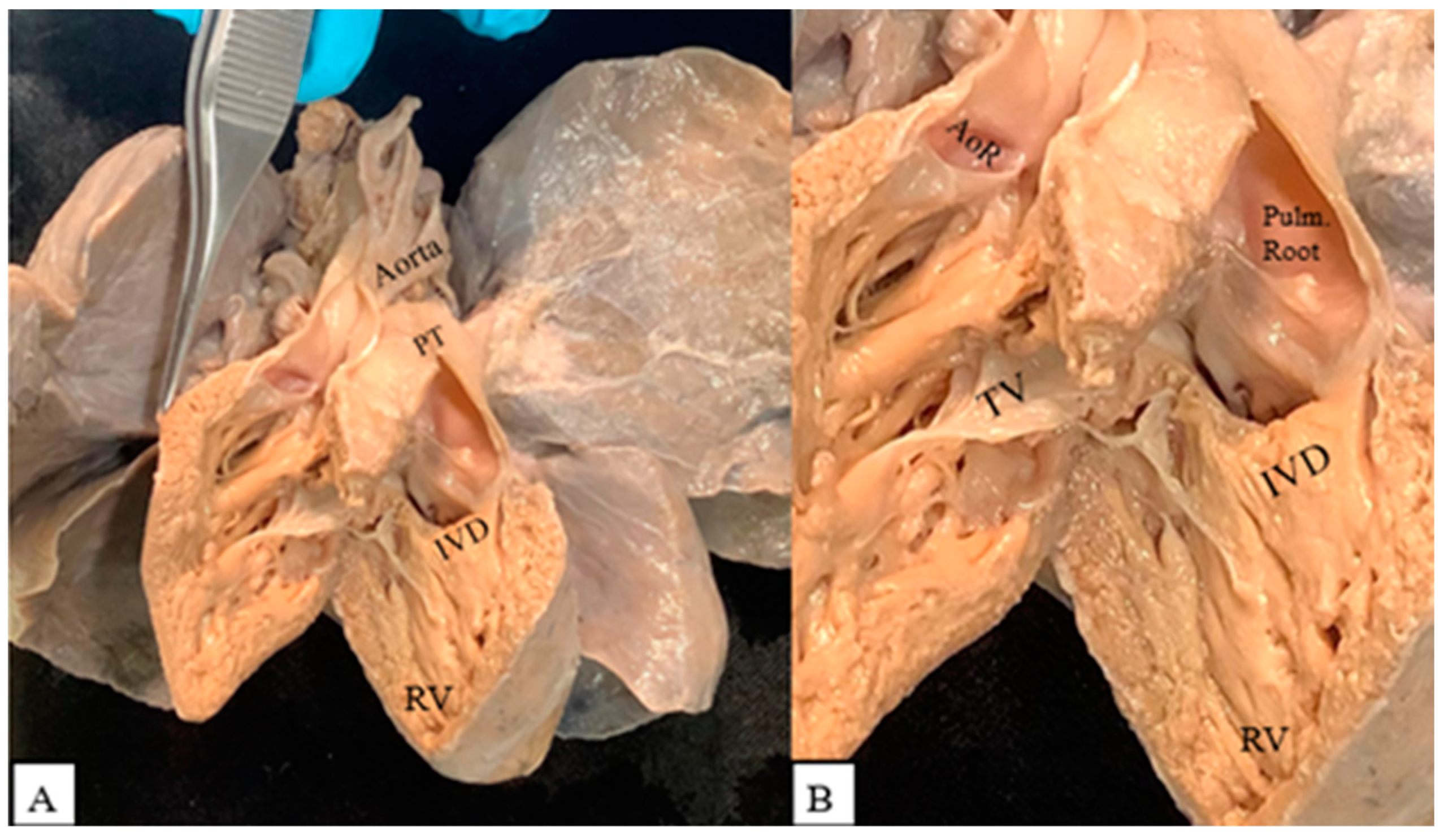Jcdd 09 00262 g001 Jcdd 09 00262 g001