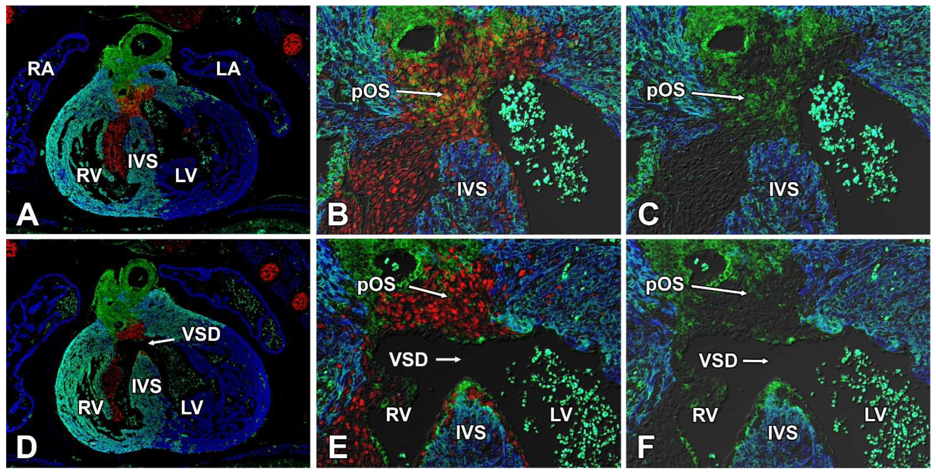 Jcdd 09 00376 g012 Jcdd 09 00376 g012