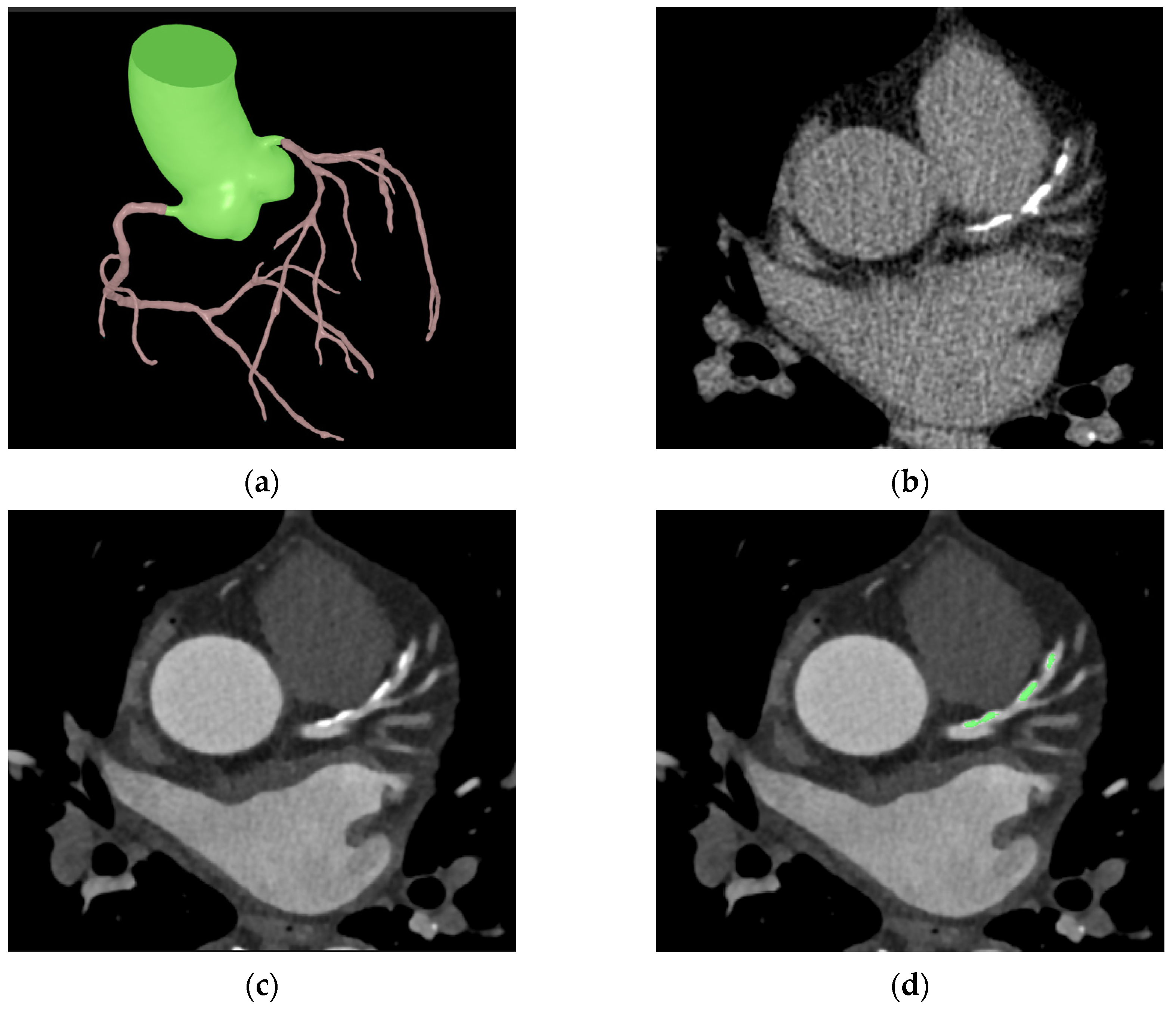 Jcdd 10 00143 g002 Jcdd 10 00143 g002