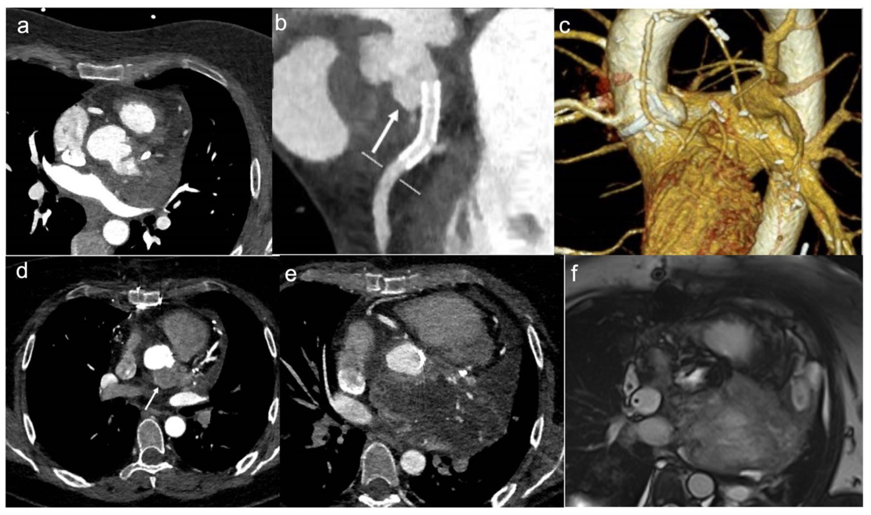 Jcdd 10 00229 g001 Jcdd 10 00229 g001