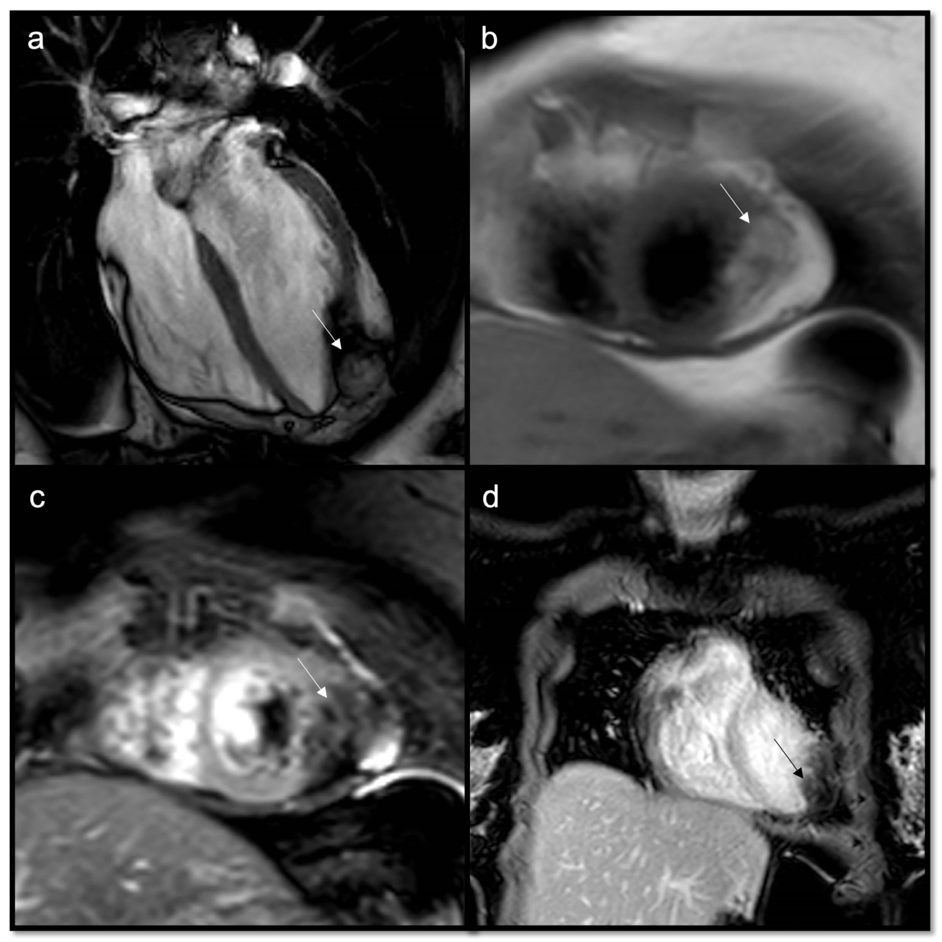 Jcdd 10 00229 g004 Jcdd 10 00229 g004