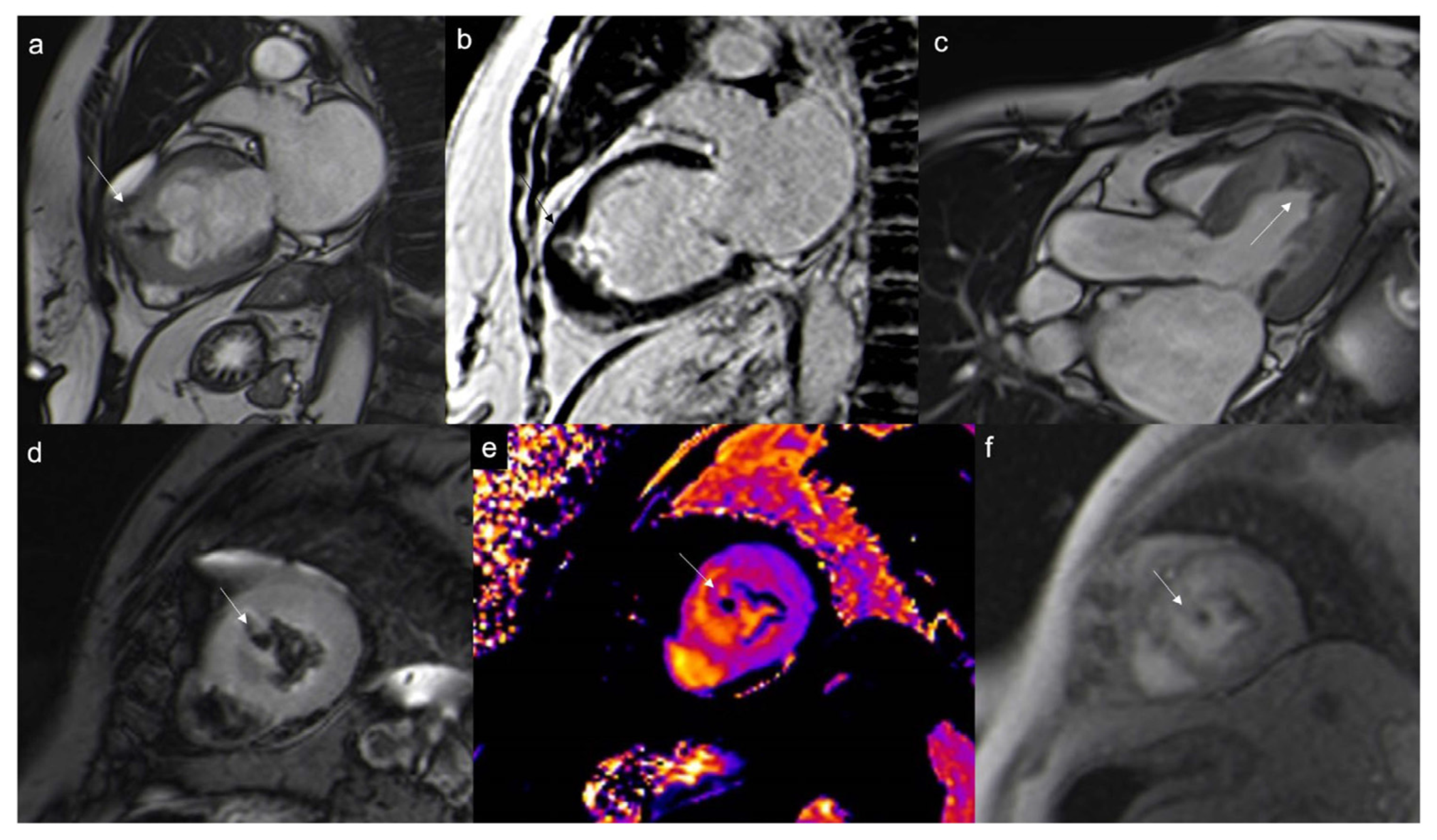 Jcdd 10 00229 g006 Jcdd 10 00229 g006