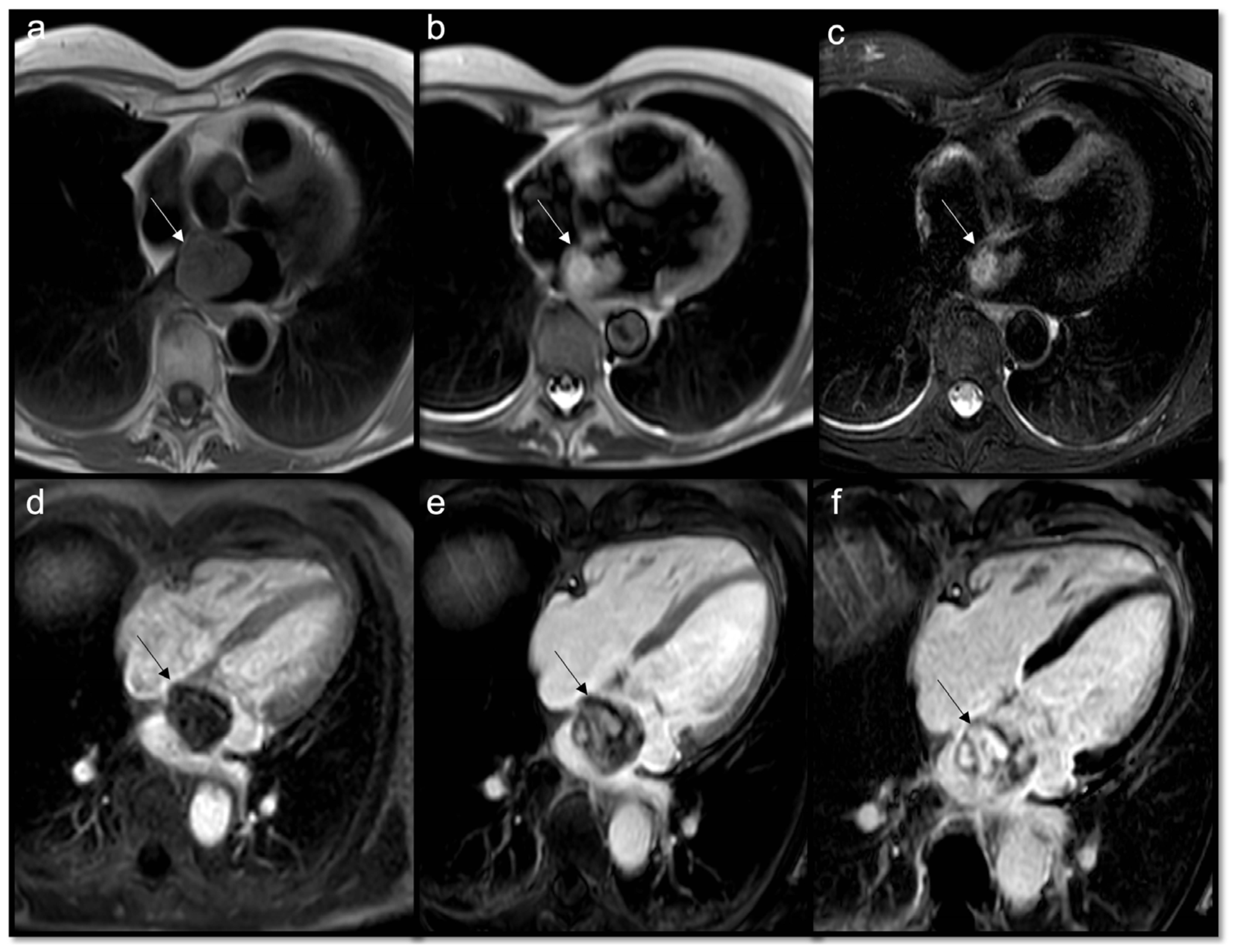 Jcdd 10 00229 g007 Jcdd 10 00229 g007