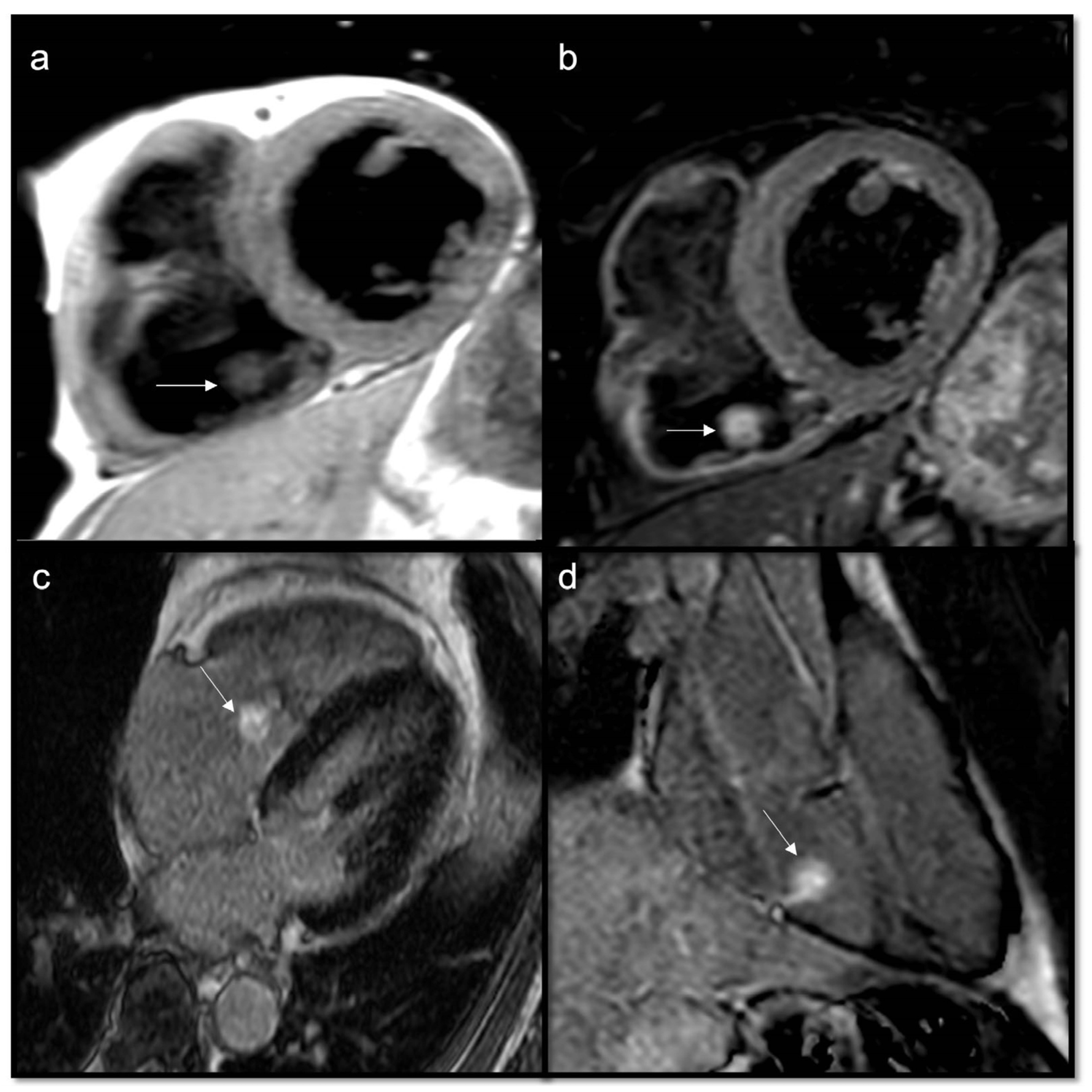 Jcdd 10 00229 g009 Jcdd 10 00229 g009