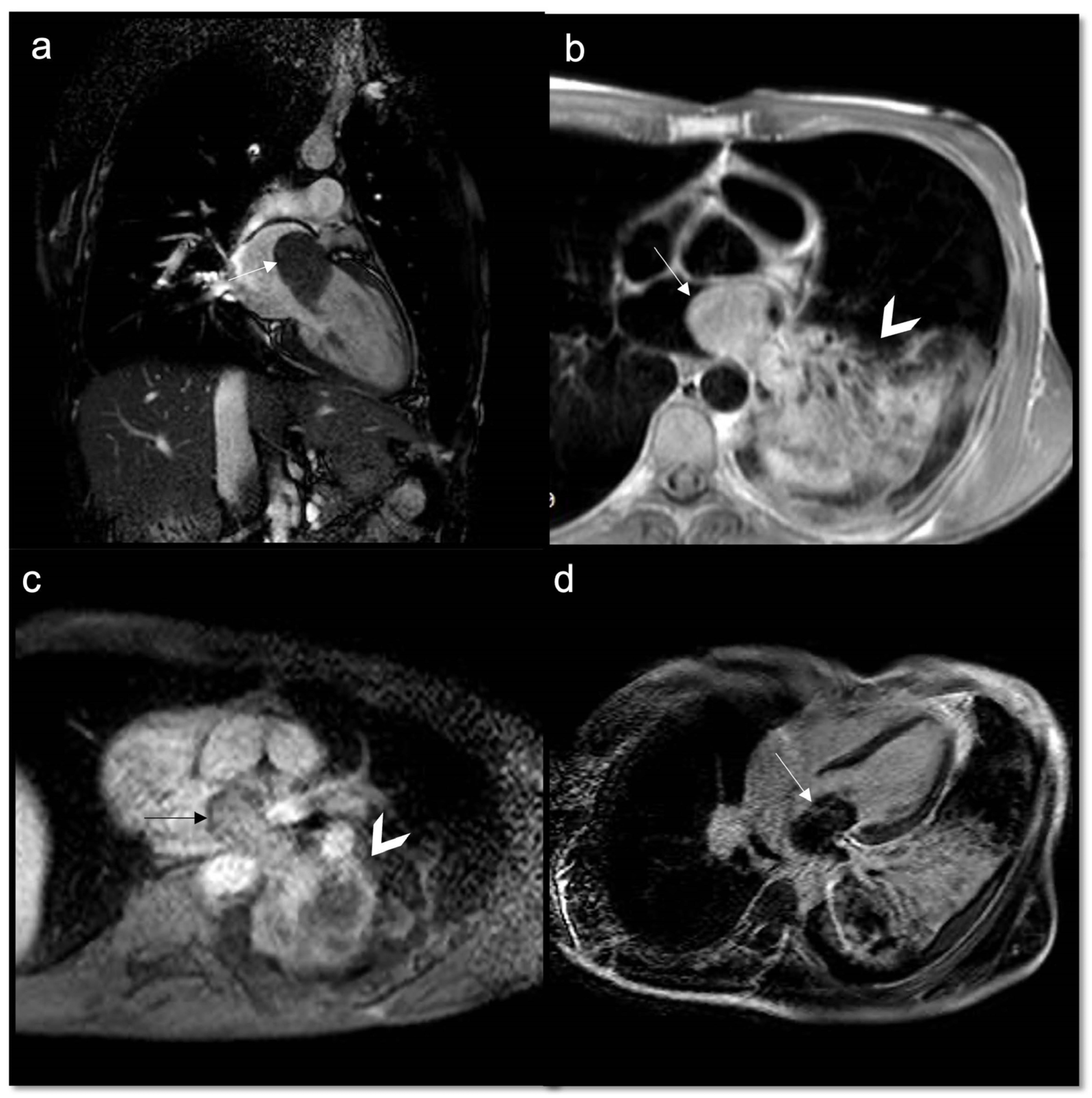 Jcdd 10 00229 g010 Jcdd 10 00229 g010