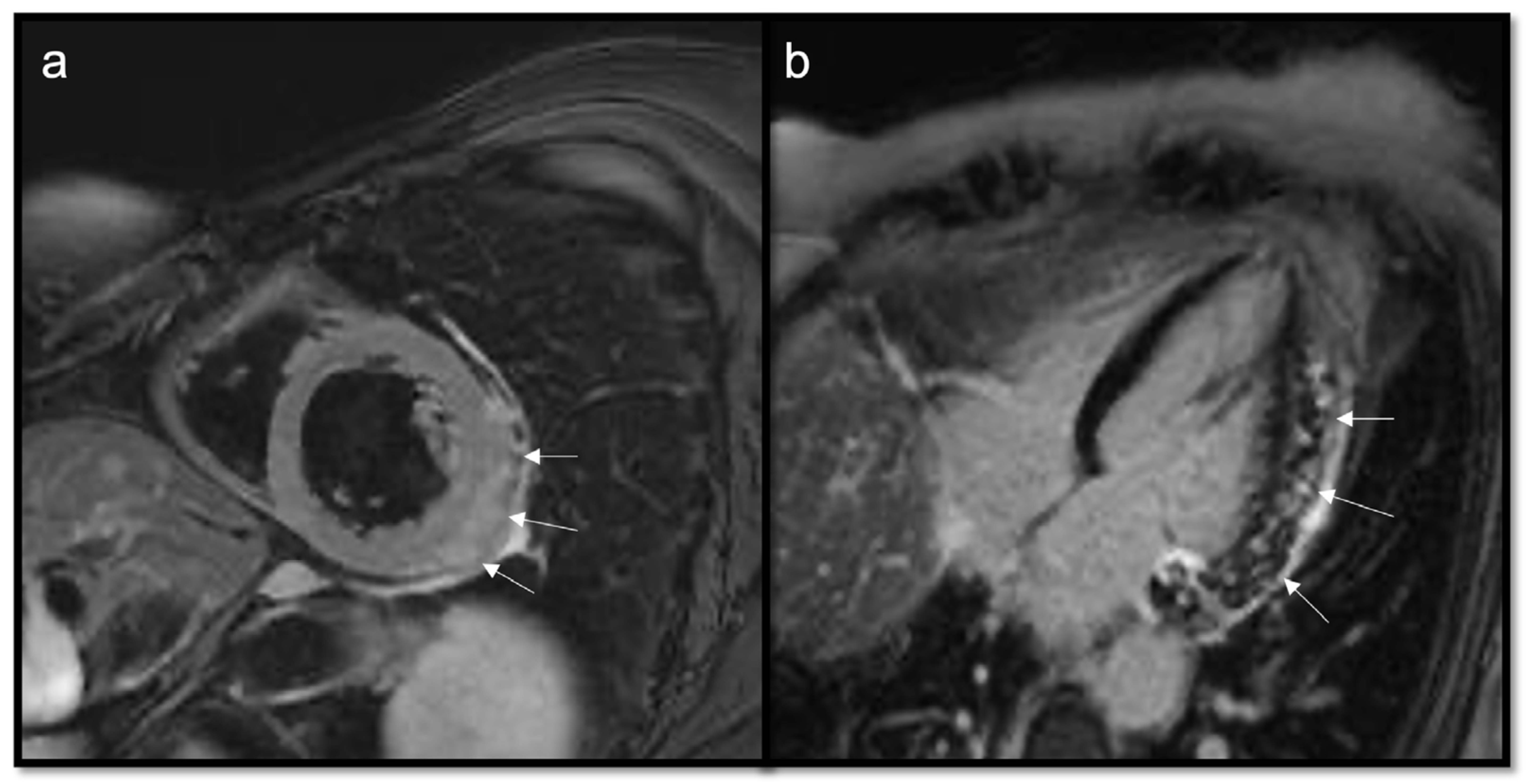 Jcdd 10 00229 g011 Jcdd 10 00229 g011