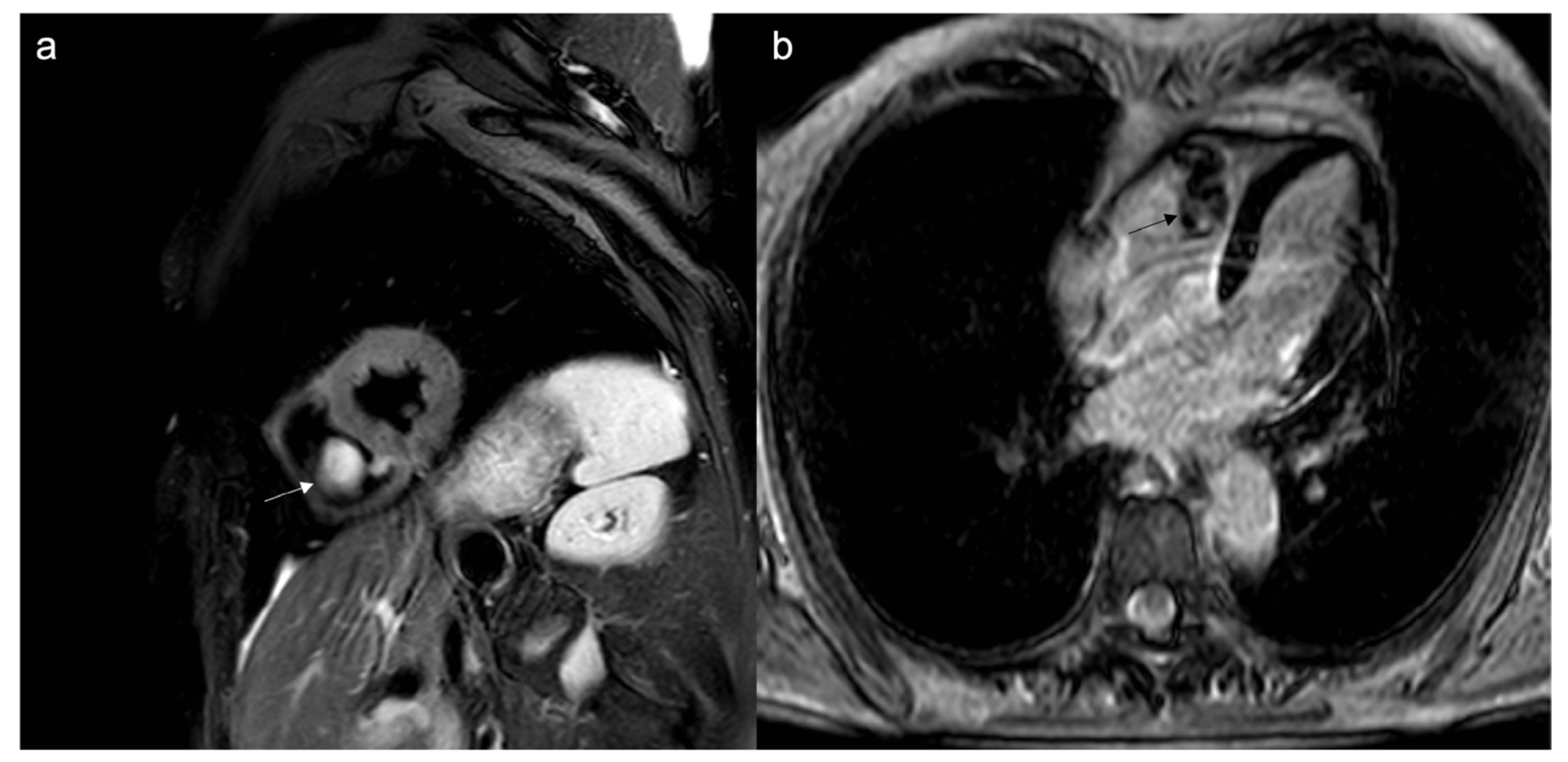 Jcdd 10 00229 g013 Jcdd 10 00229 g013
