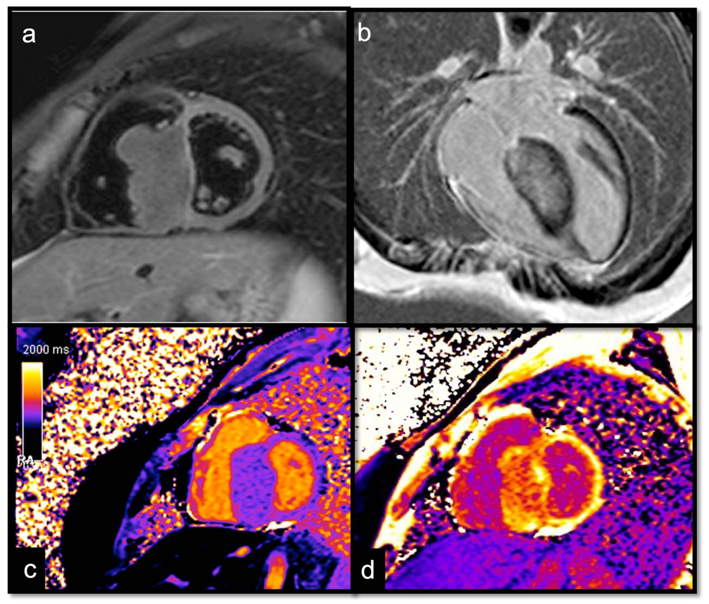 Jcdd 10 00229 g014 Jcdd 10 00229 g014