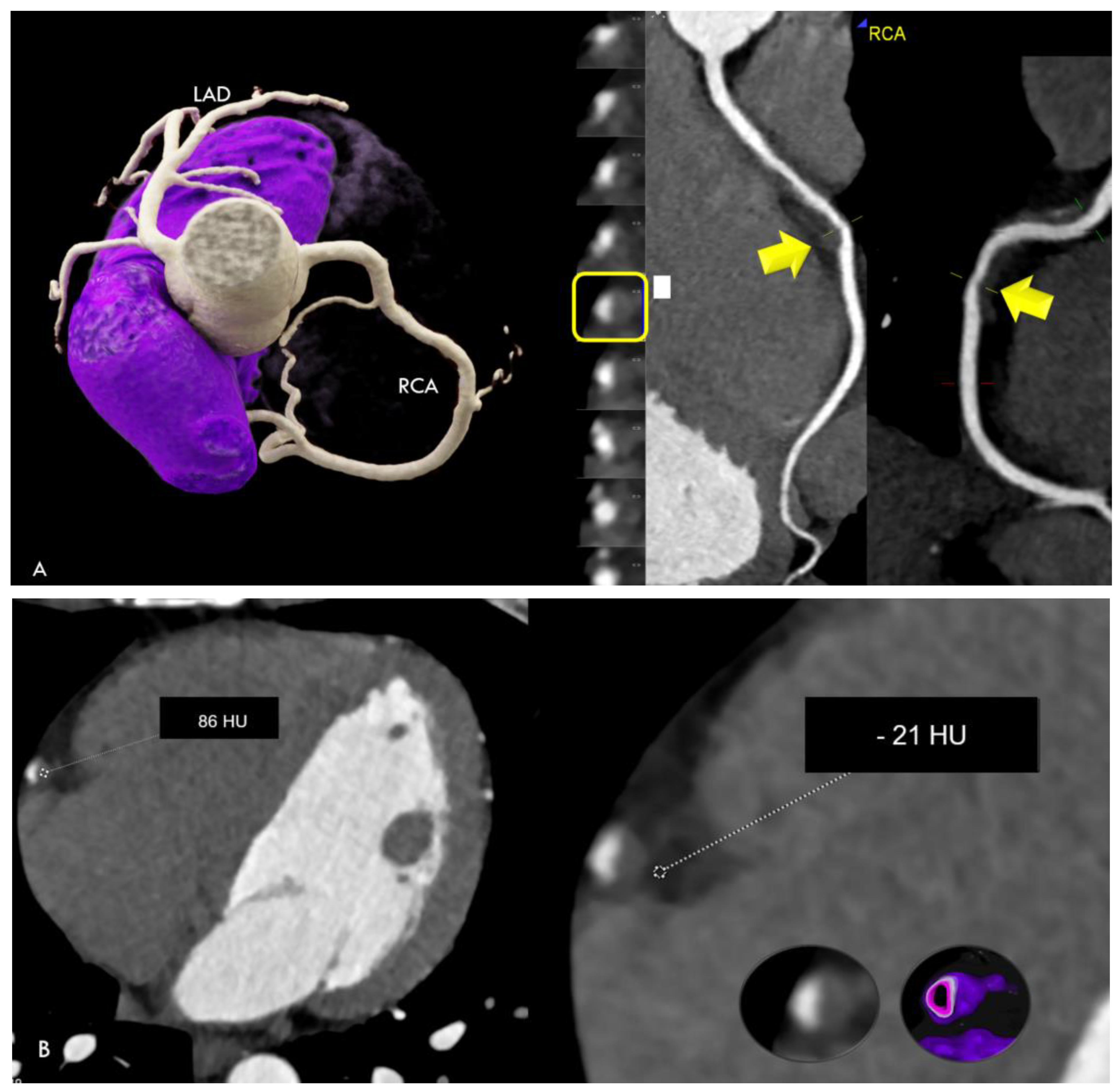 Jcdd 11 00325 g001a Jcdd 11 00325 g001a
