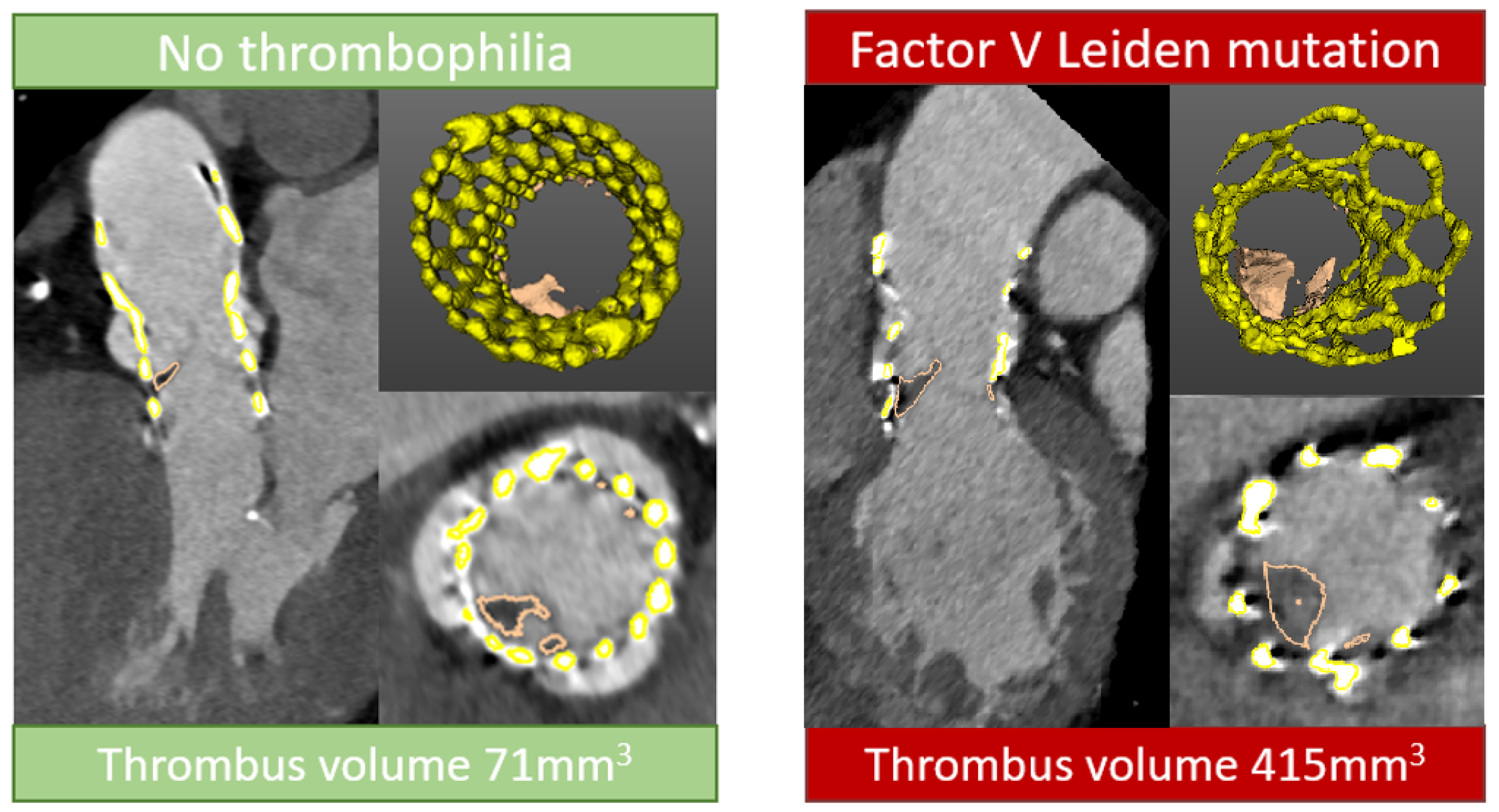 Jcdd 12 00062 g003 Jcdd 12 00062 g003
