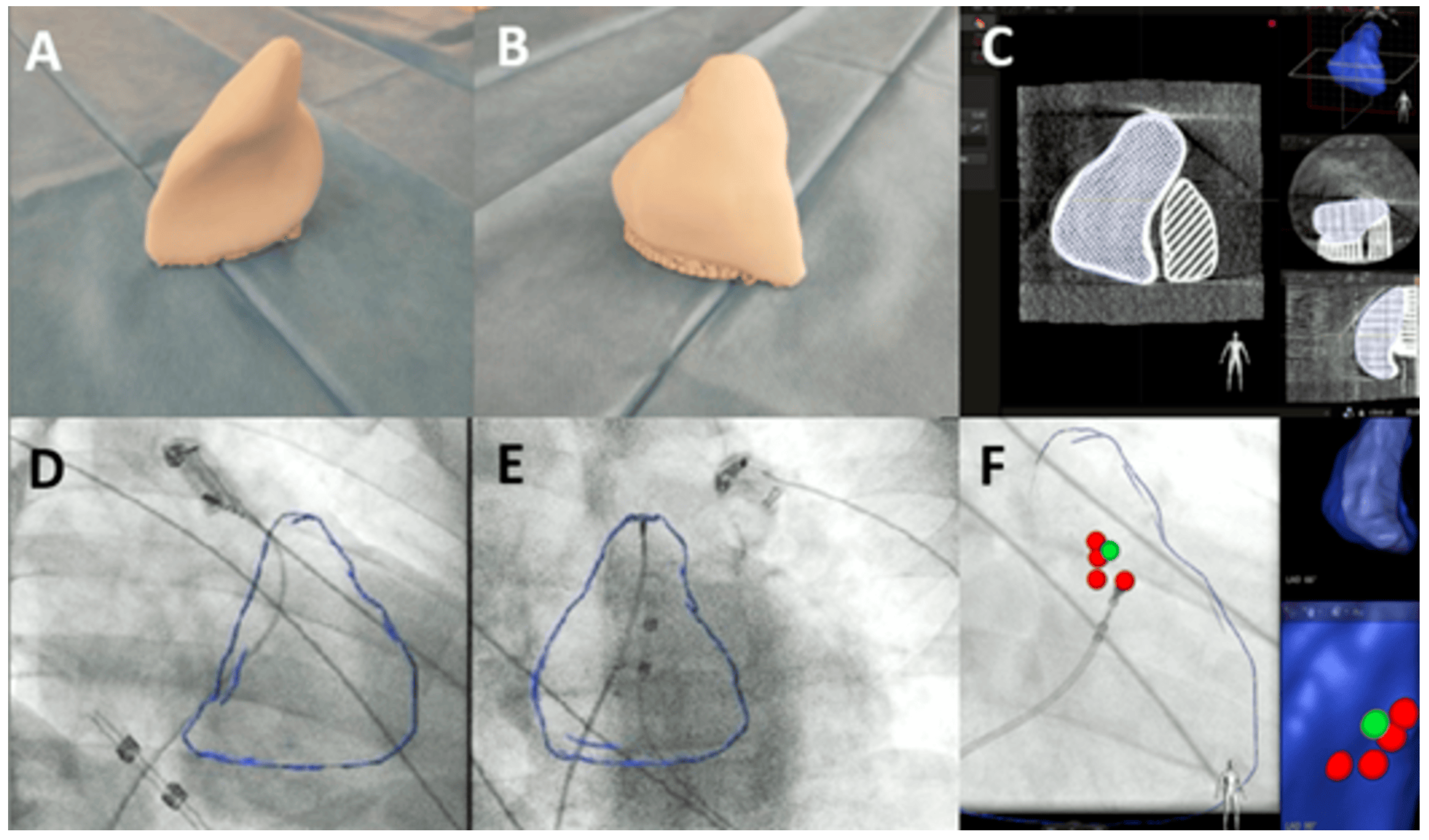 Jcdd 12 00323 g003 Jcdd 12 00323 g003