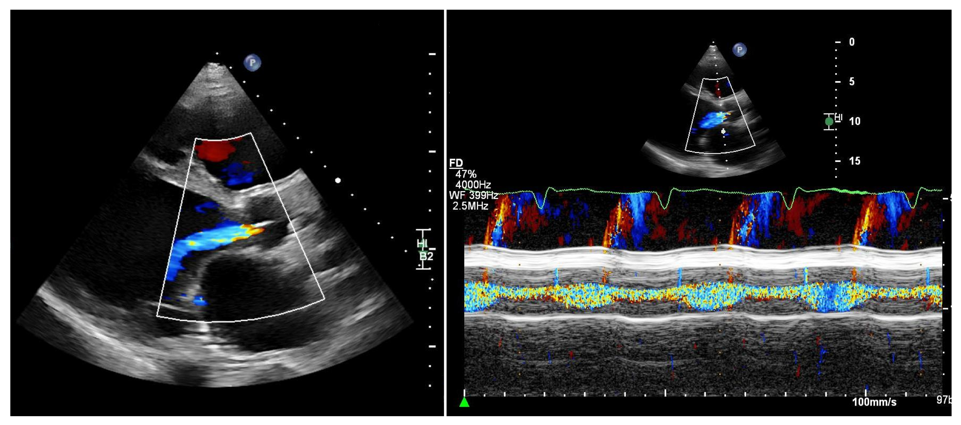 Jcdd 13 00070 g002 Jcdd 13 00070 g002