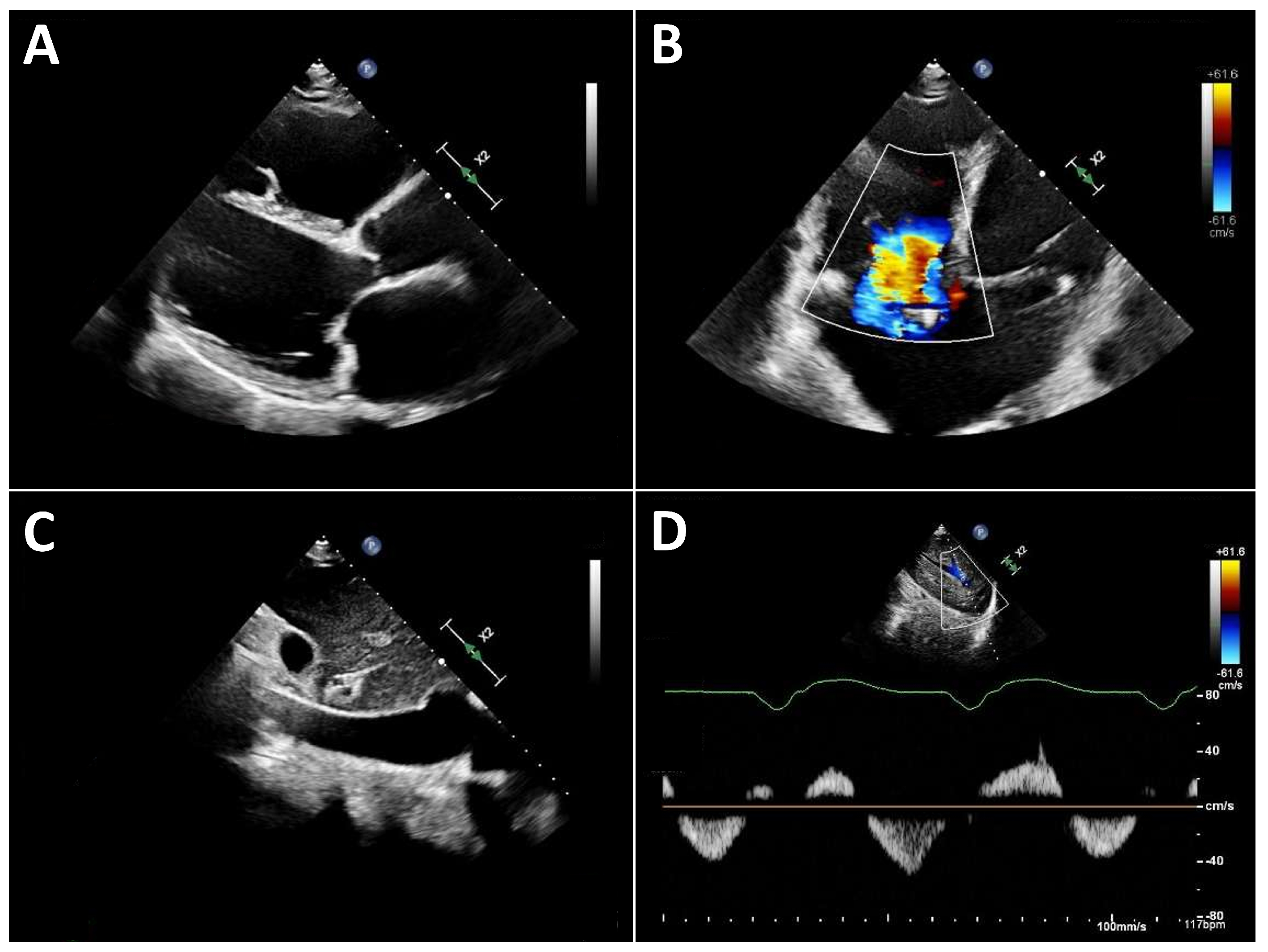 Jcdd 13 00070 g003 Jcdd 13 00070 g003
