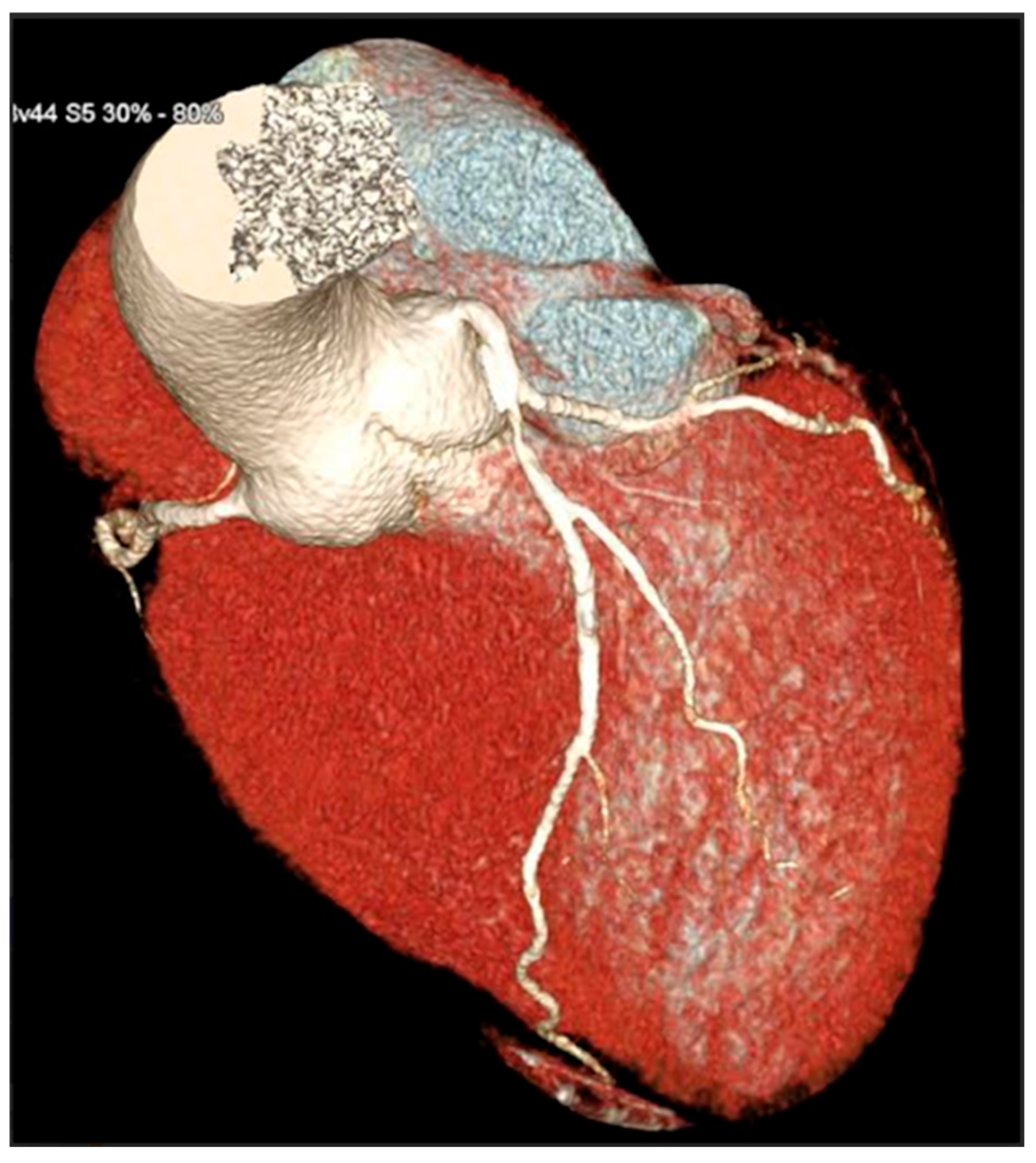 Jcdd 13 00088 g003 Jcdd 13 00088 g003