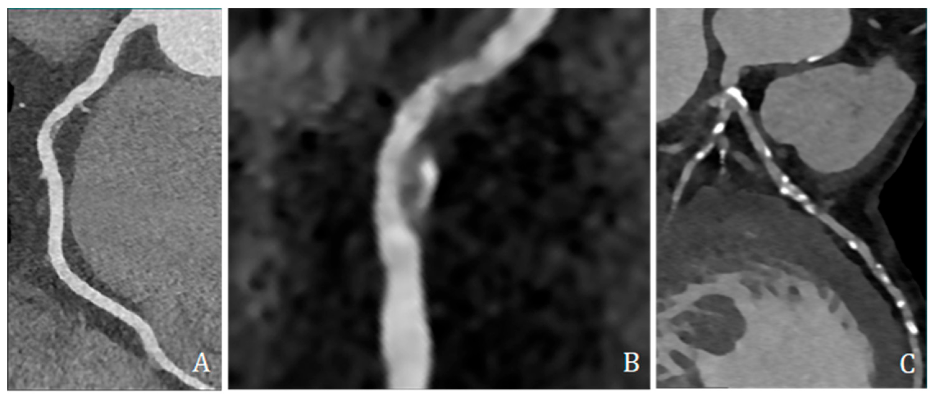 Jcdd 13 00088 g004 Jcdd 13 00088 g004