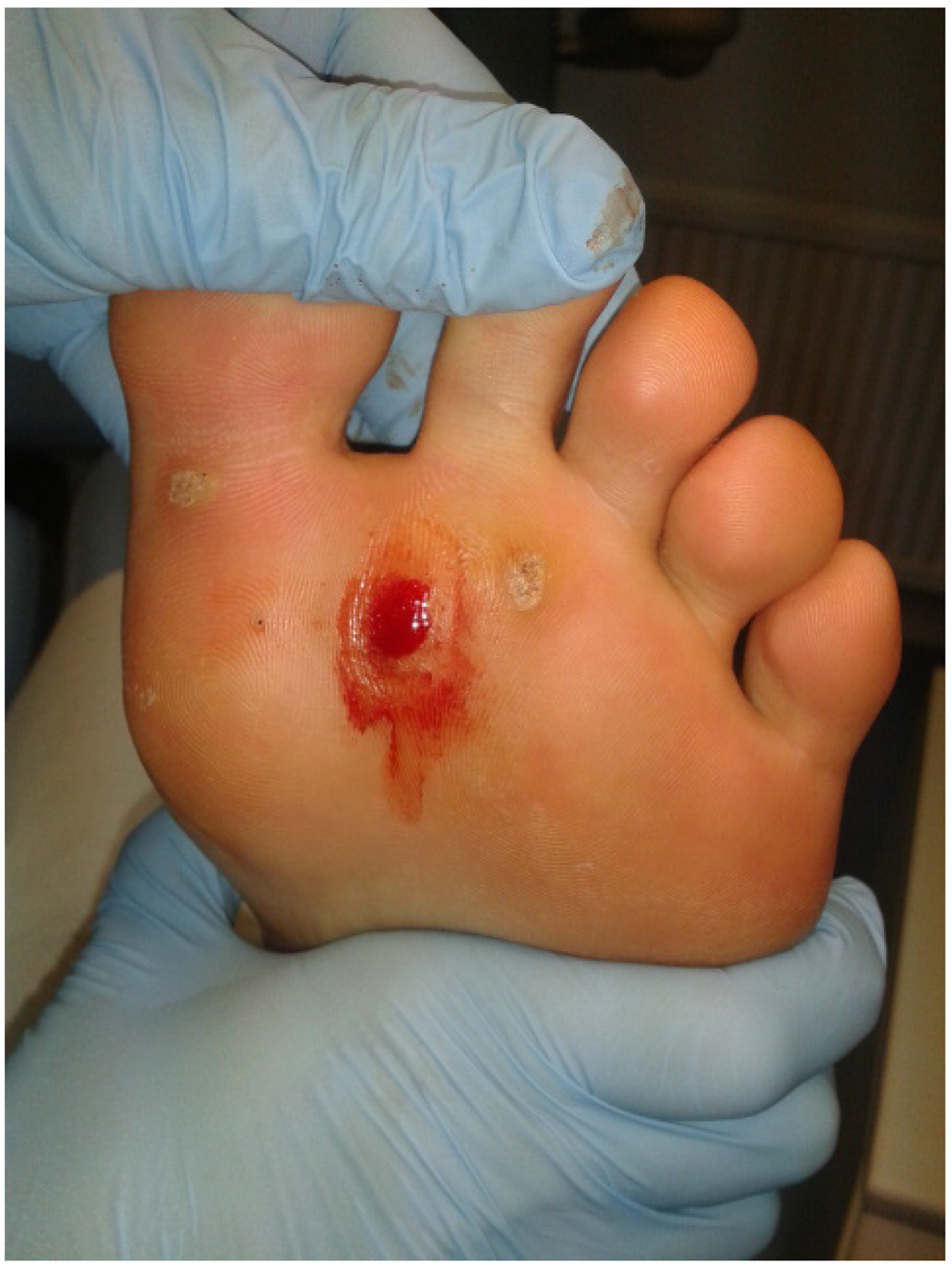 Jcm 02 00013 g002 1024